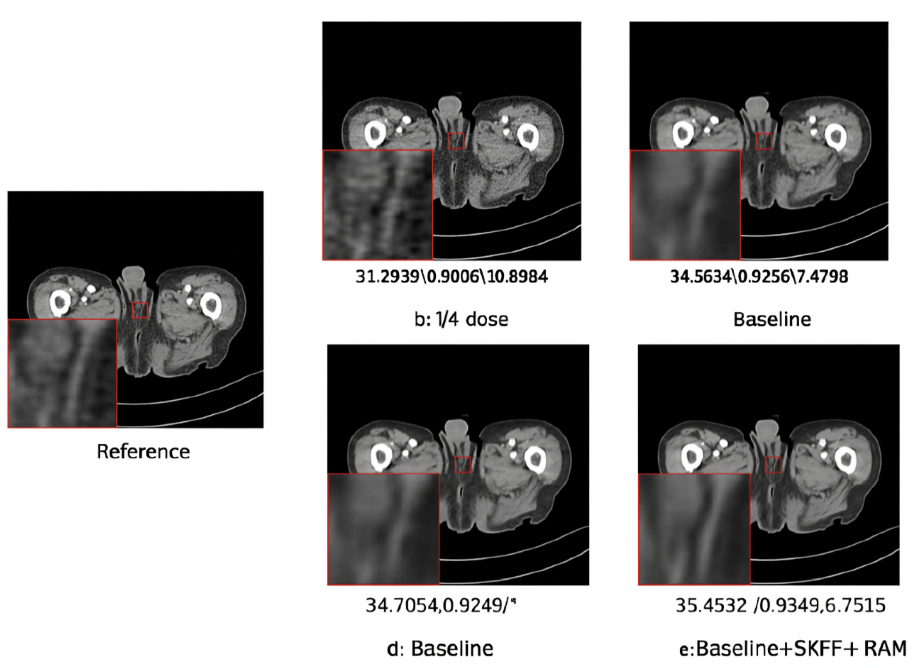 Preprints 169662 g004