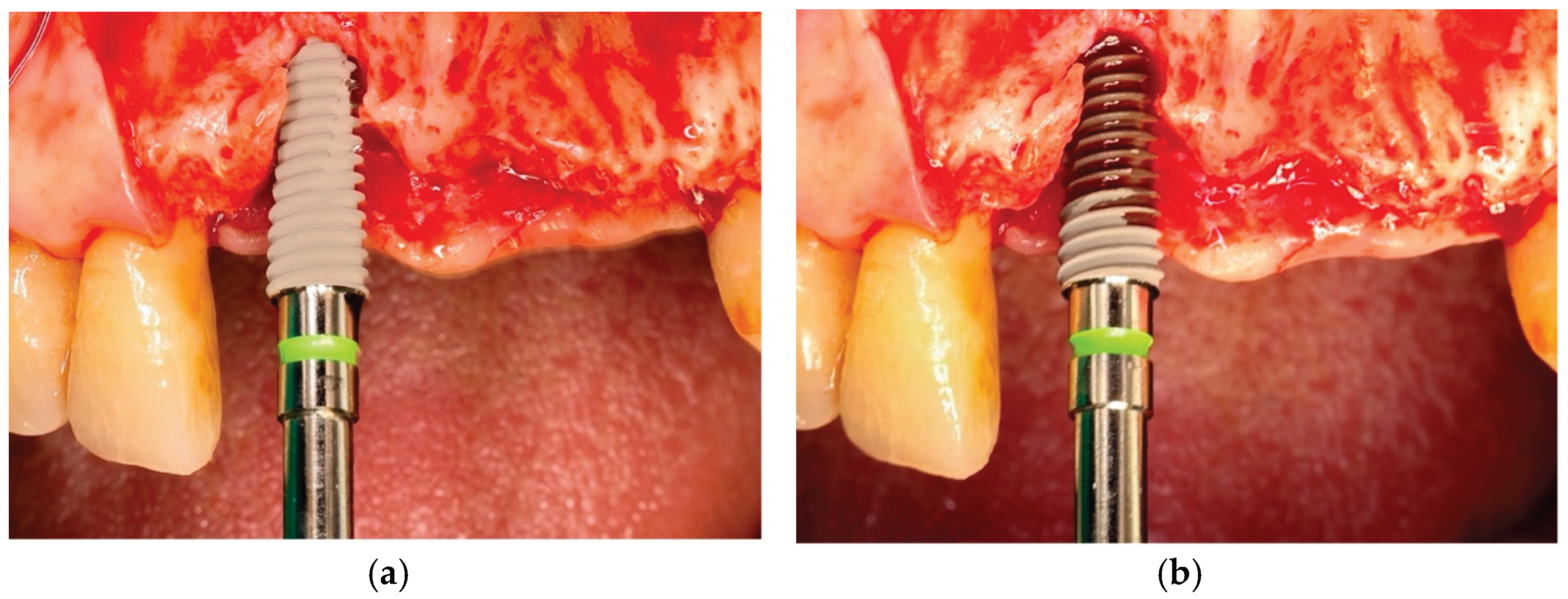 Preprints 175417 g001