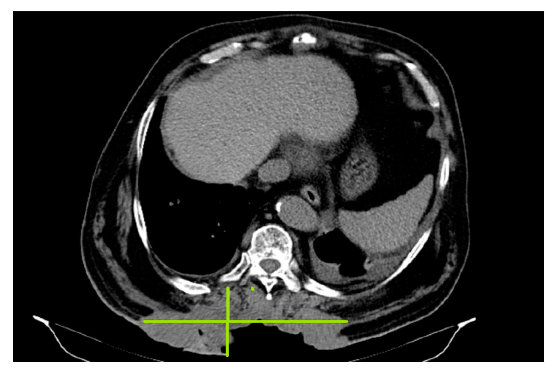 Preprints 163318 g002