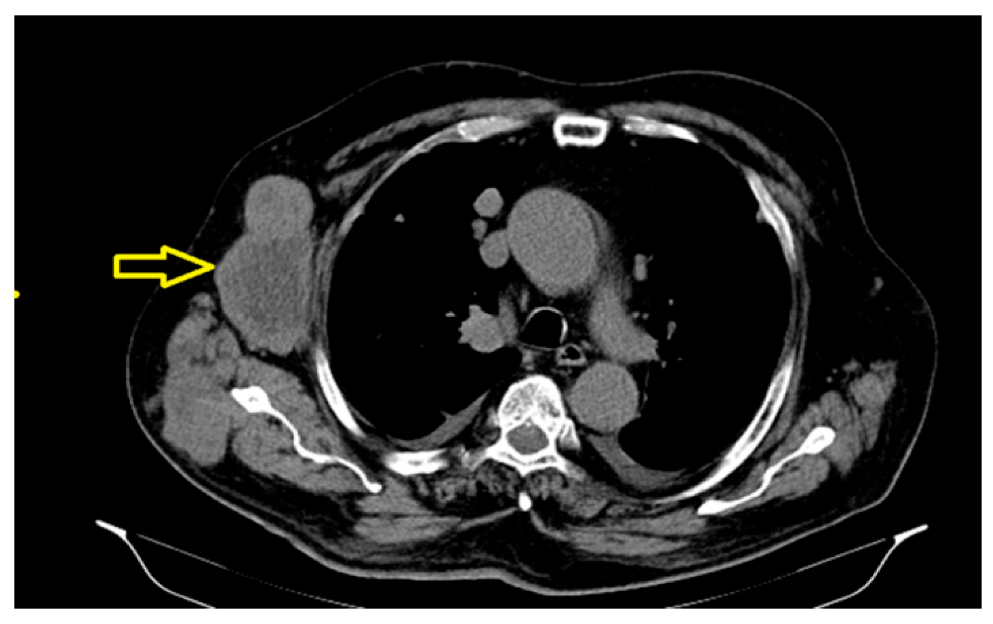 Preprints 163318 g004