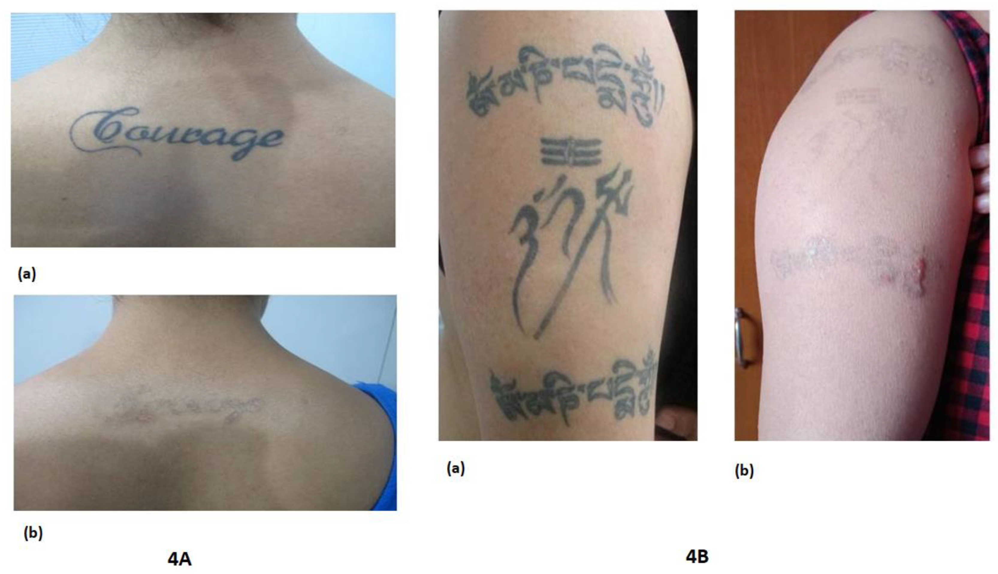 Preprints 86497 g004