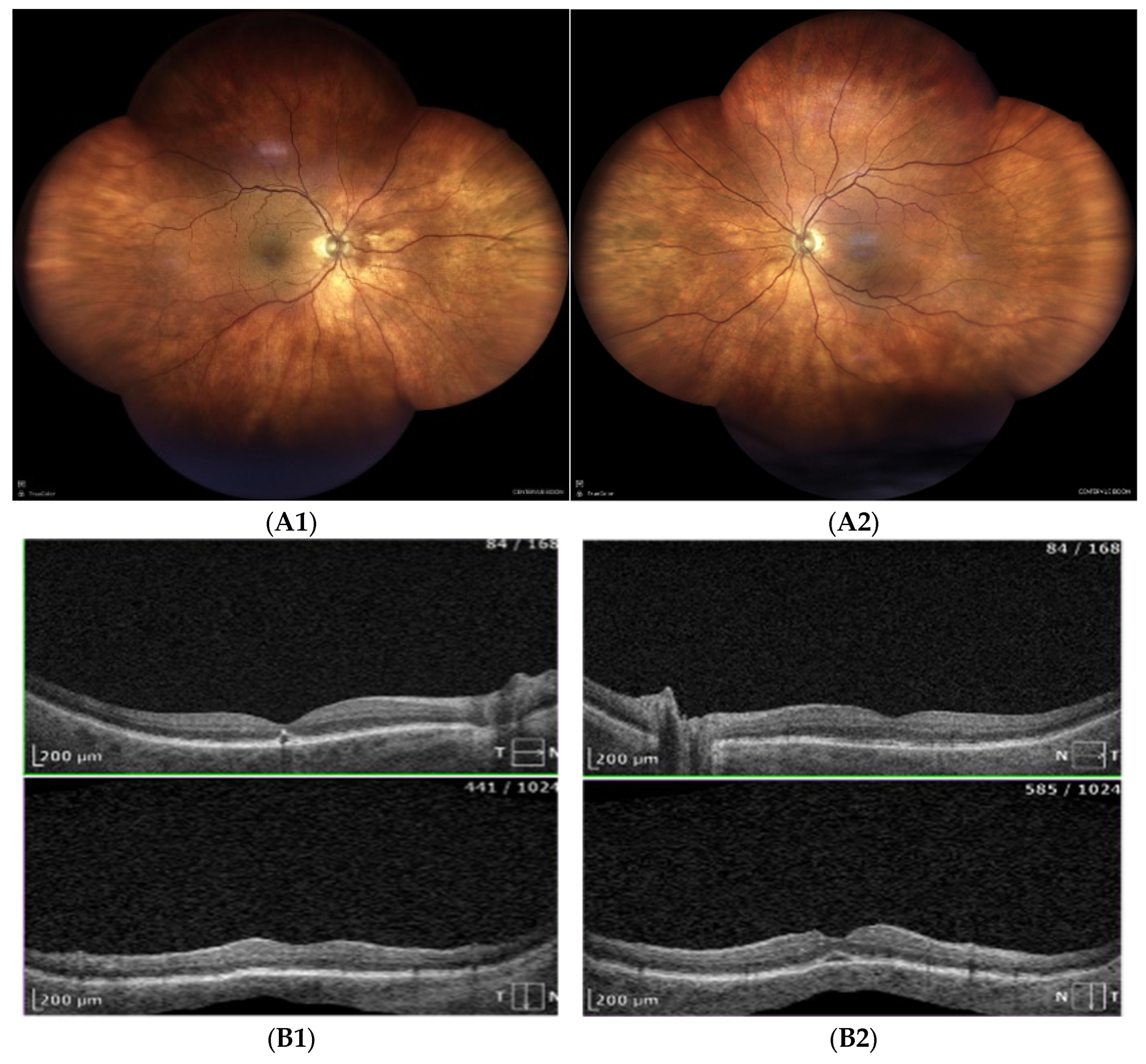 Preprints 156044 g004