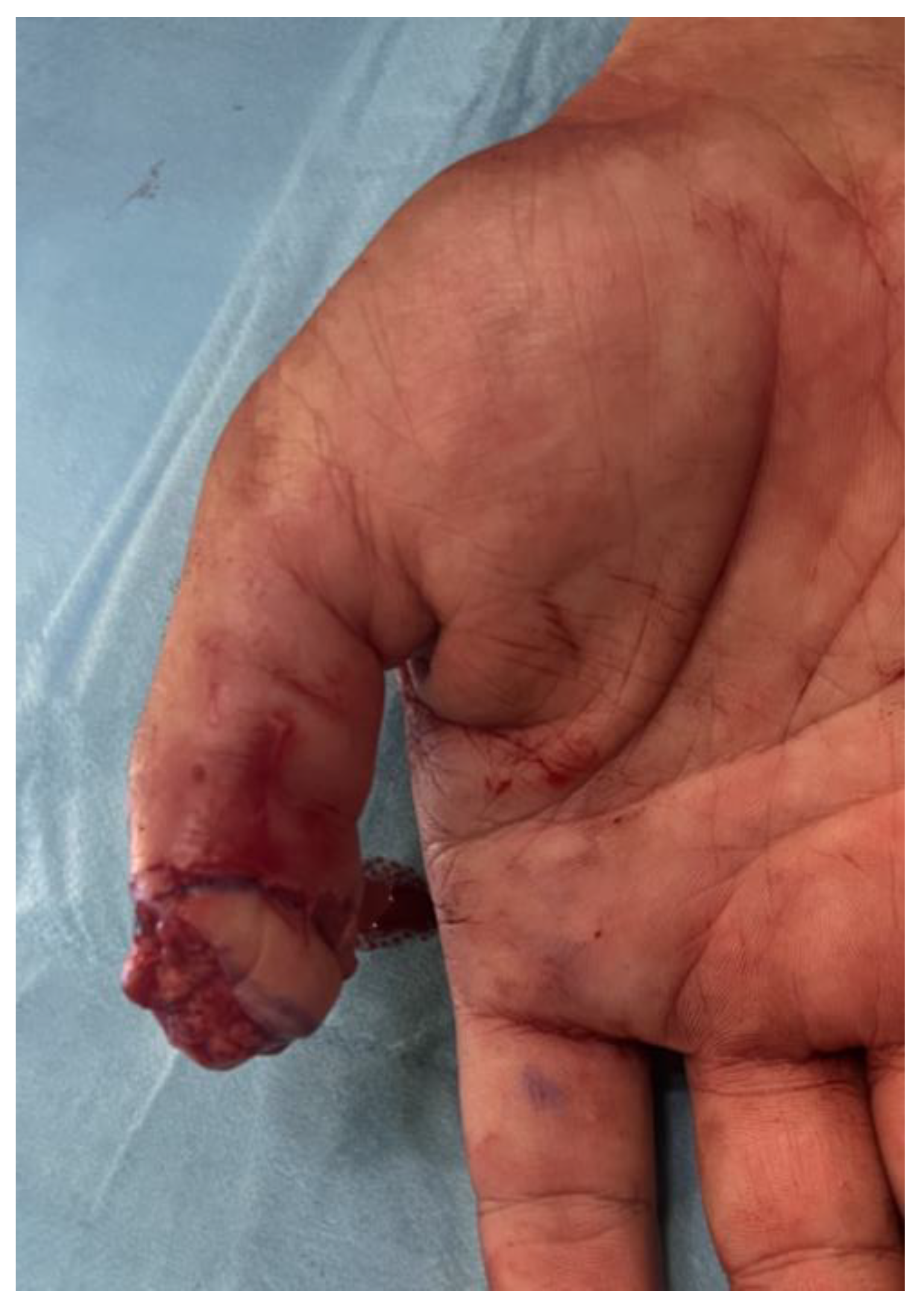 Preprints 192382 g005