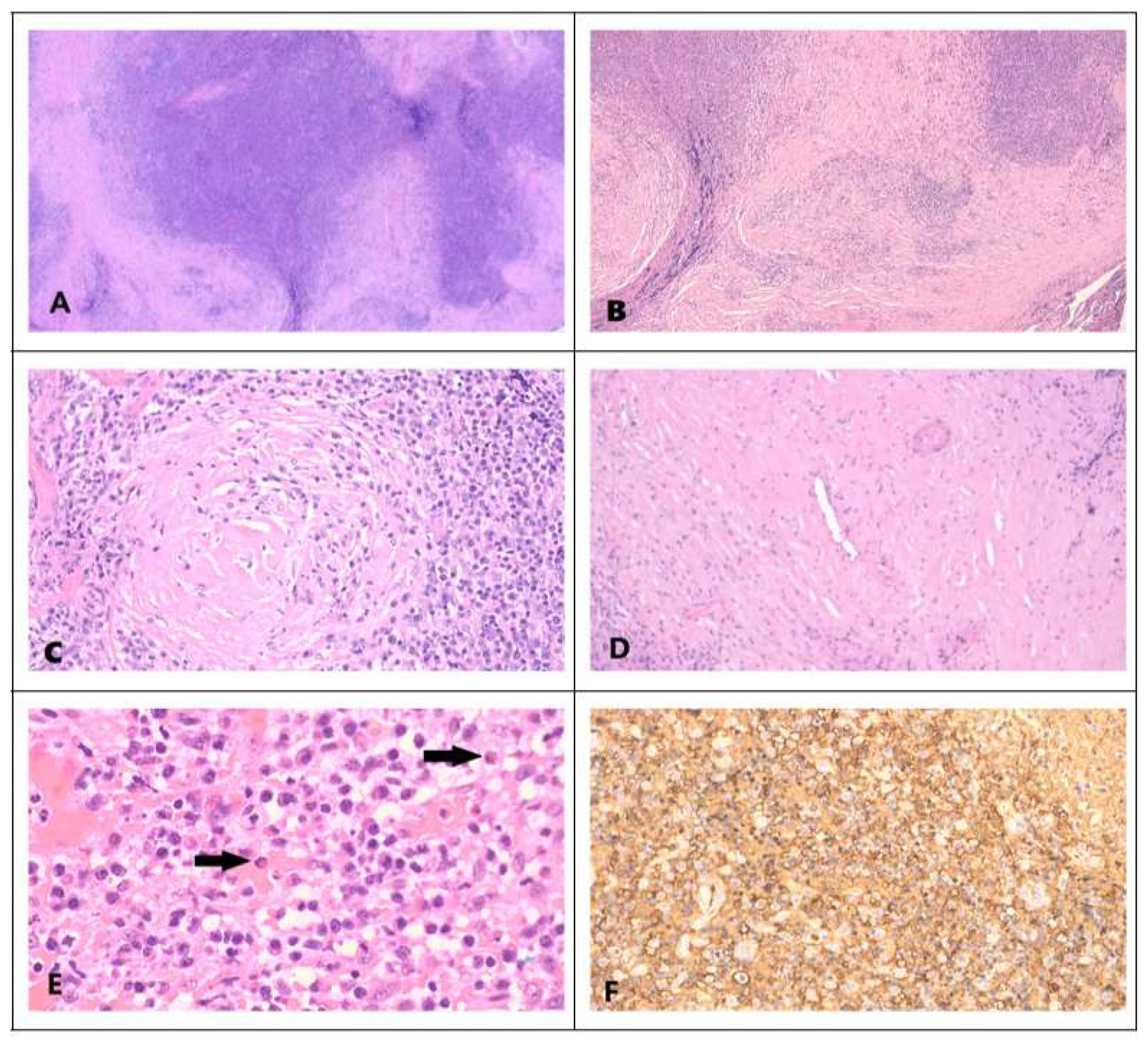 Preprints 148306 g002