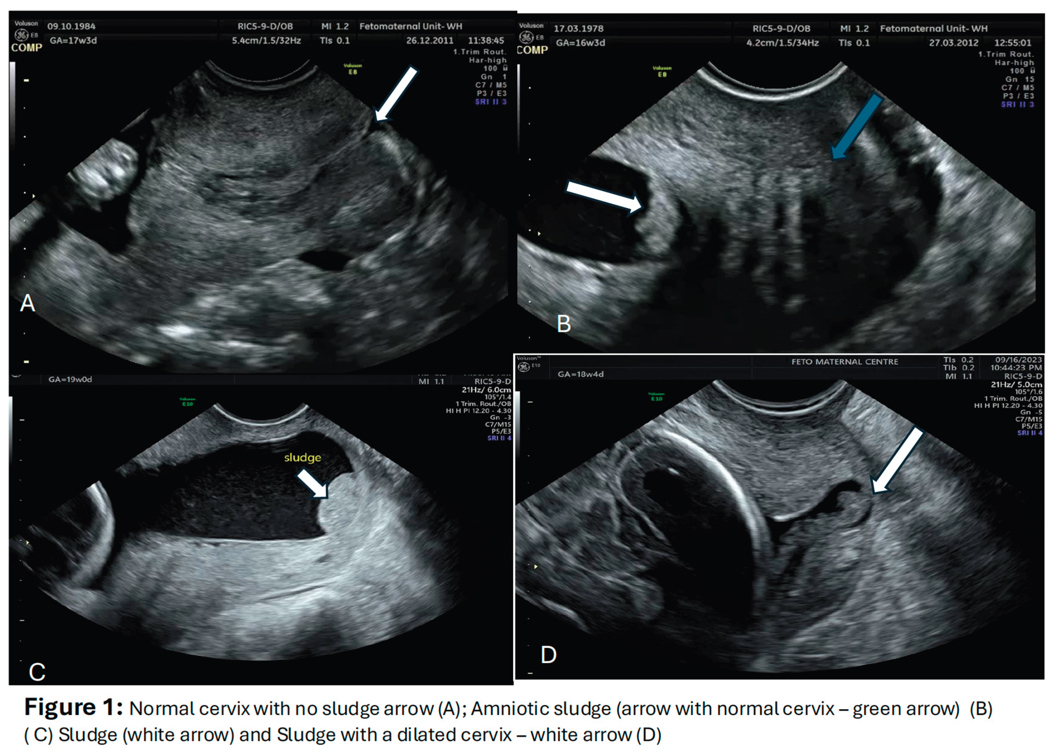 Preprints 164847 g001