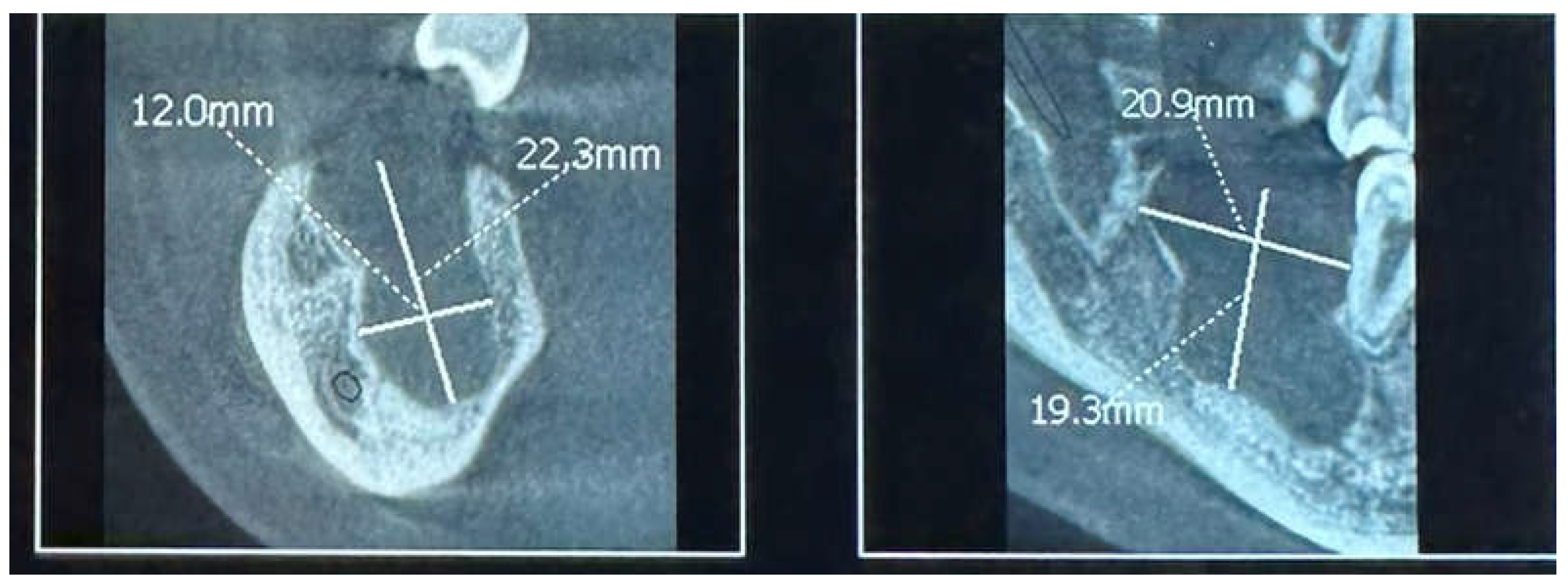 Preprints 153534 g003