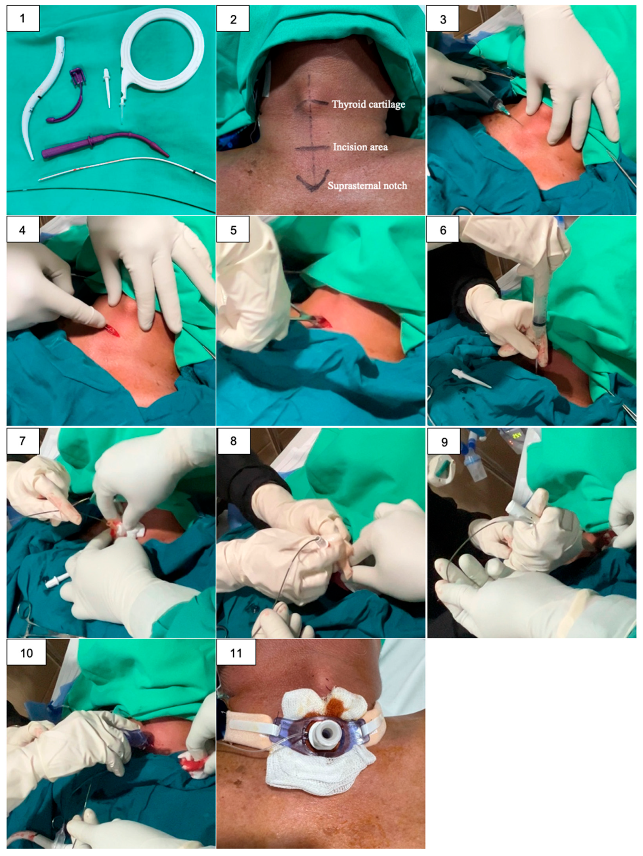 Preprints 179343 g001