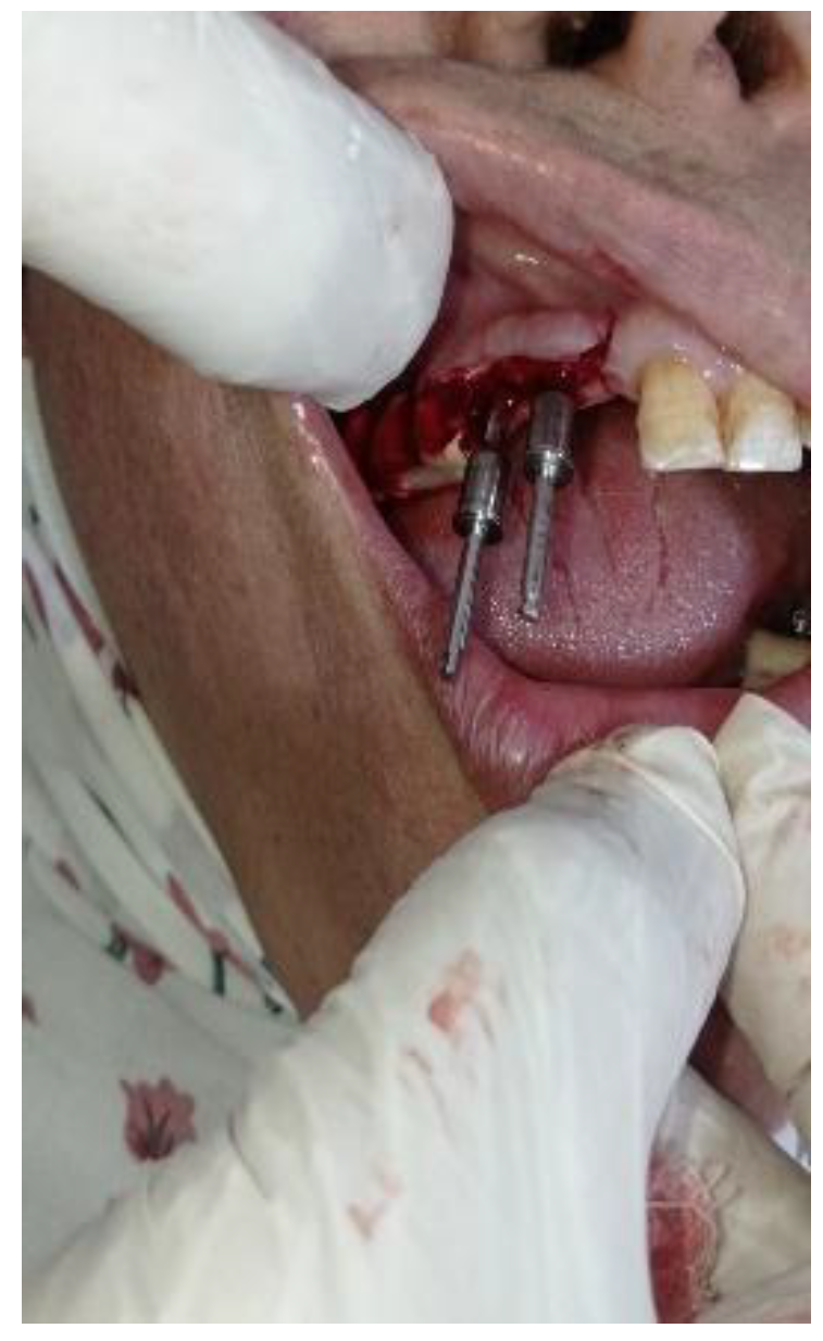 Preprints 158717 g001