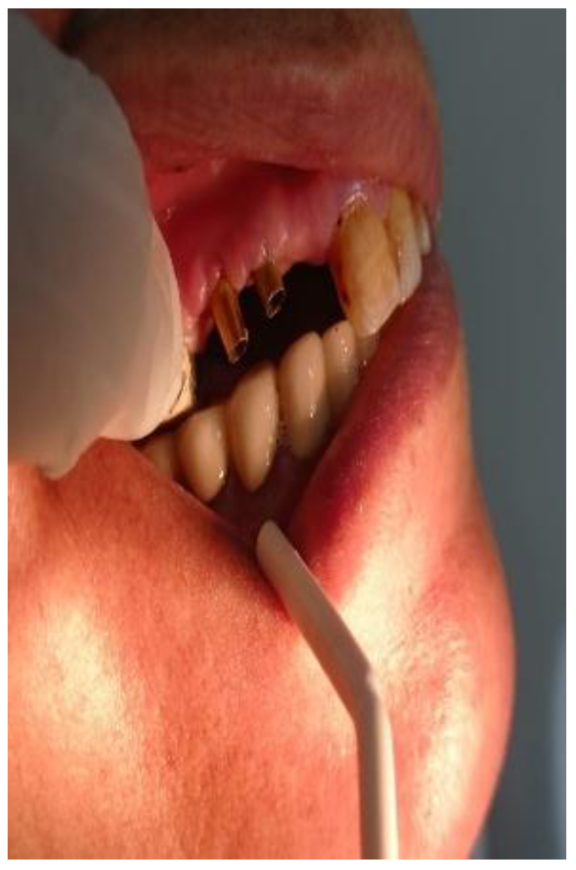 Preprints 158717 g002