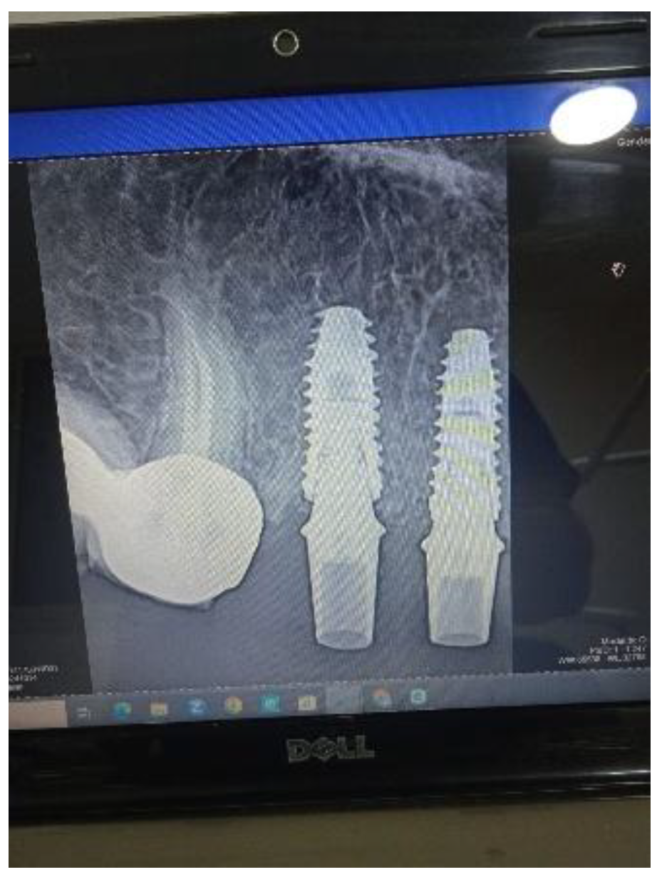 Preprints 158717 g003