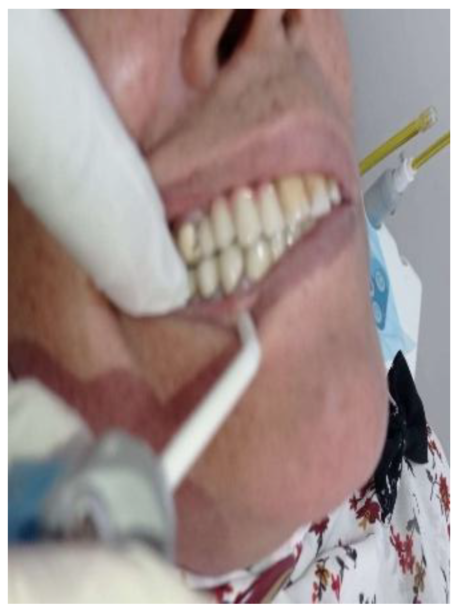 Preprints 158717 g004