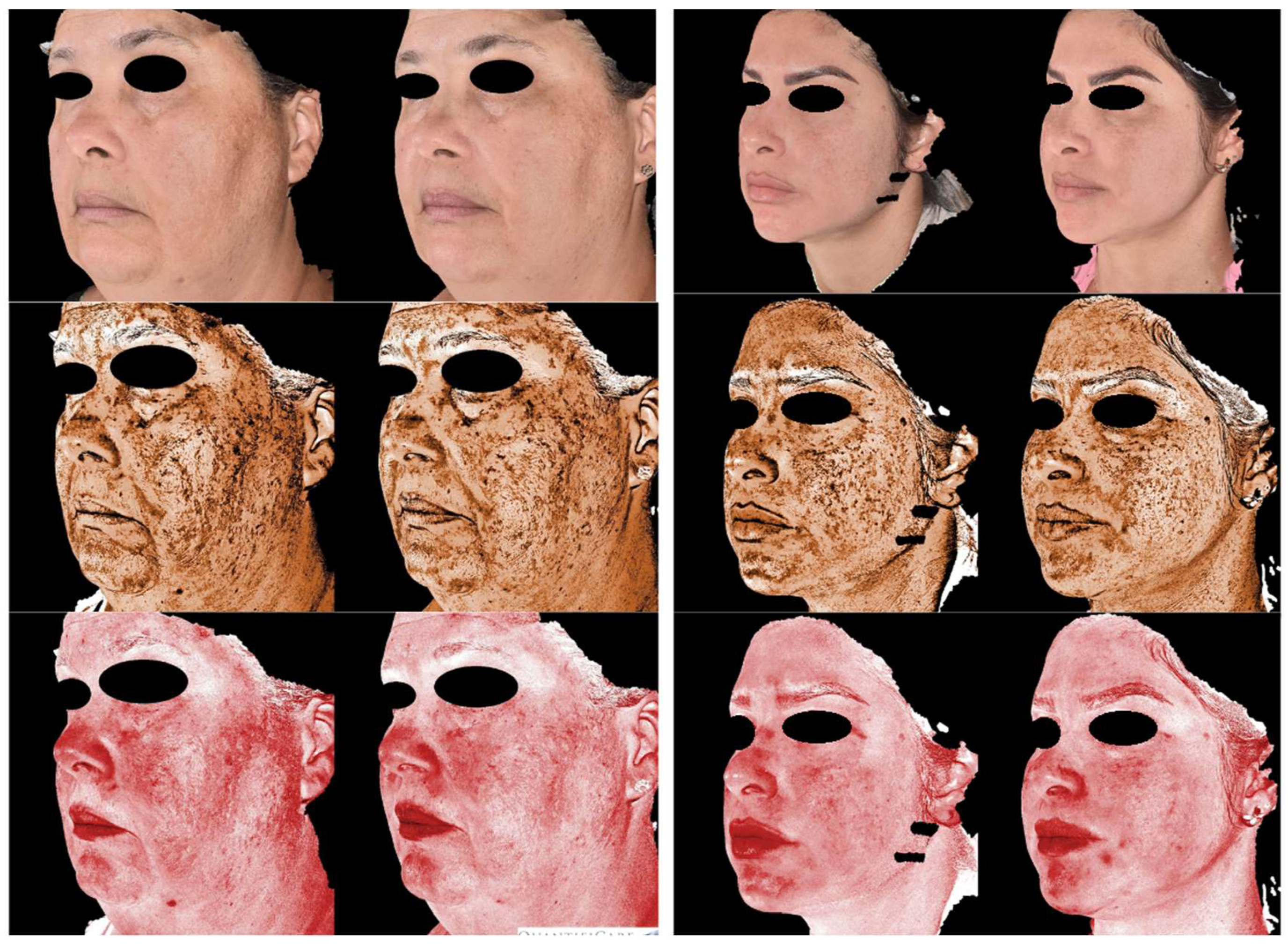 Preprints 159159 g001