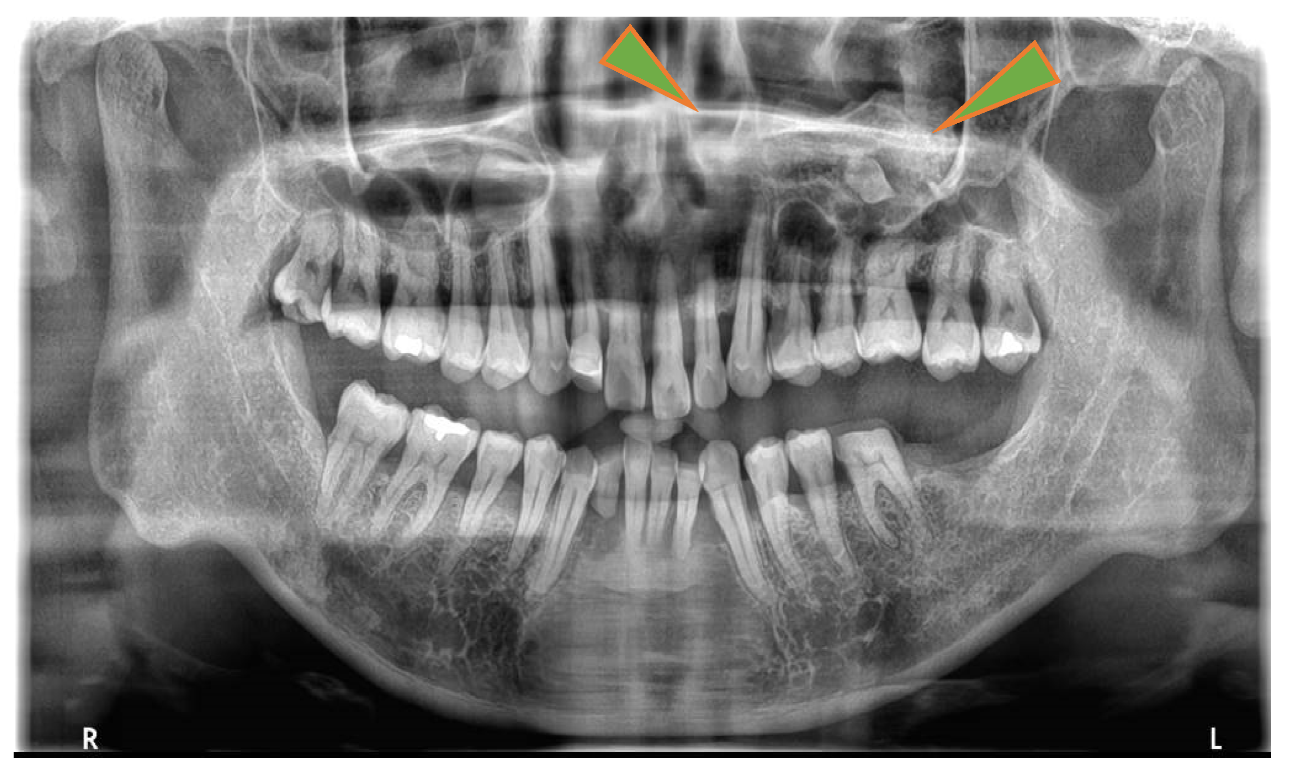 Preprints 110324 g001