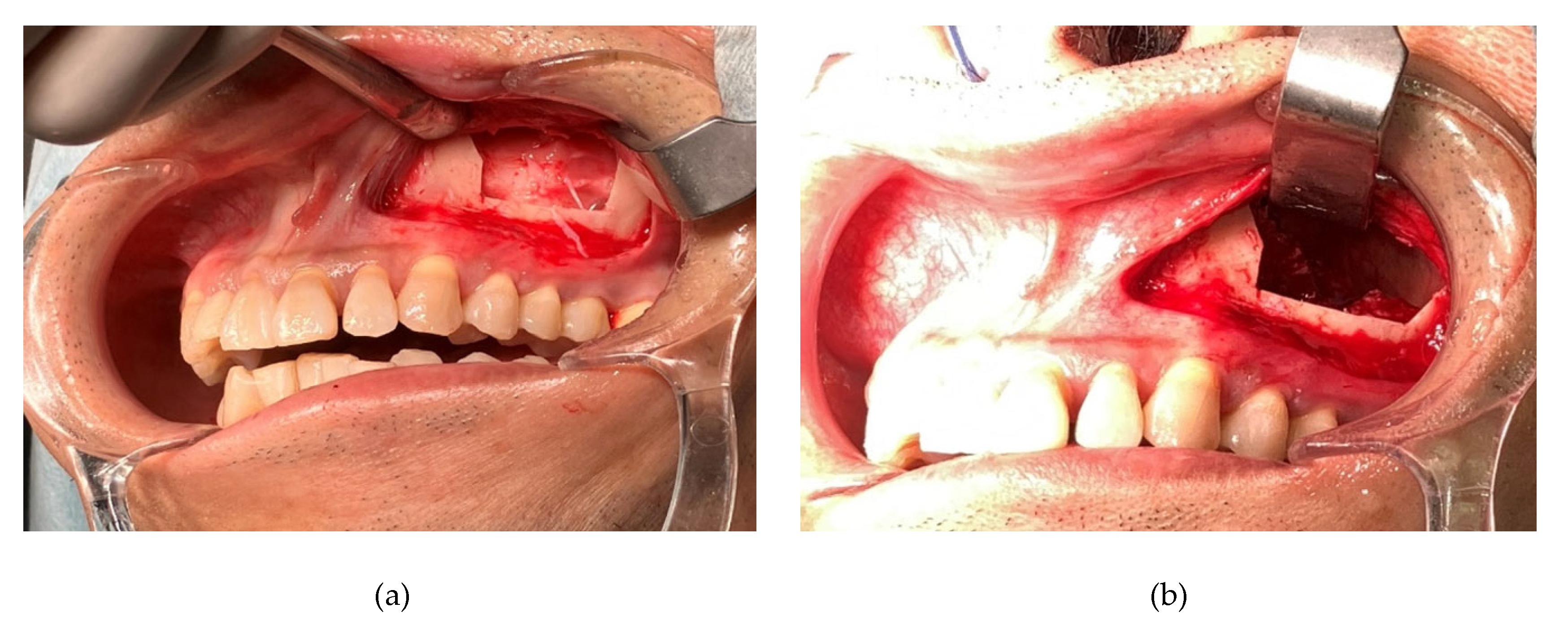 Preprints 110324 g003