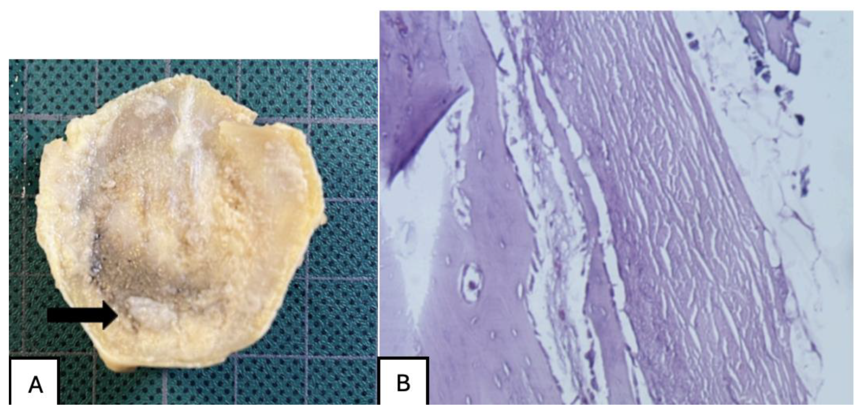 Preprints 161691 g032
