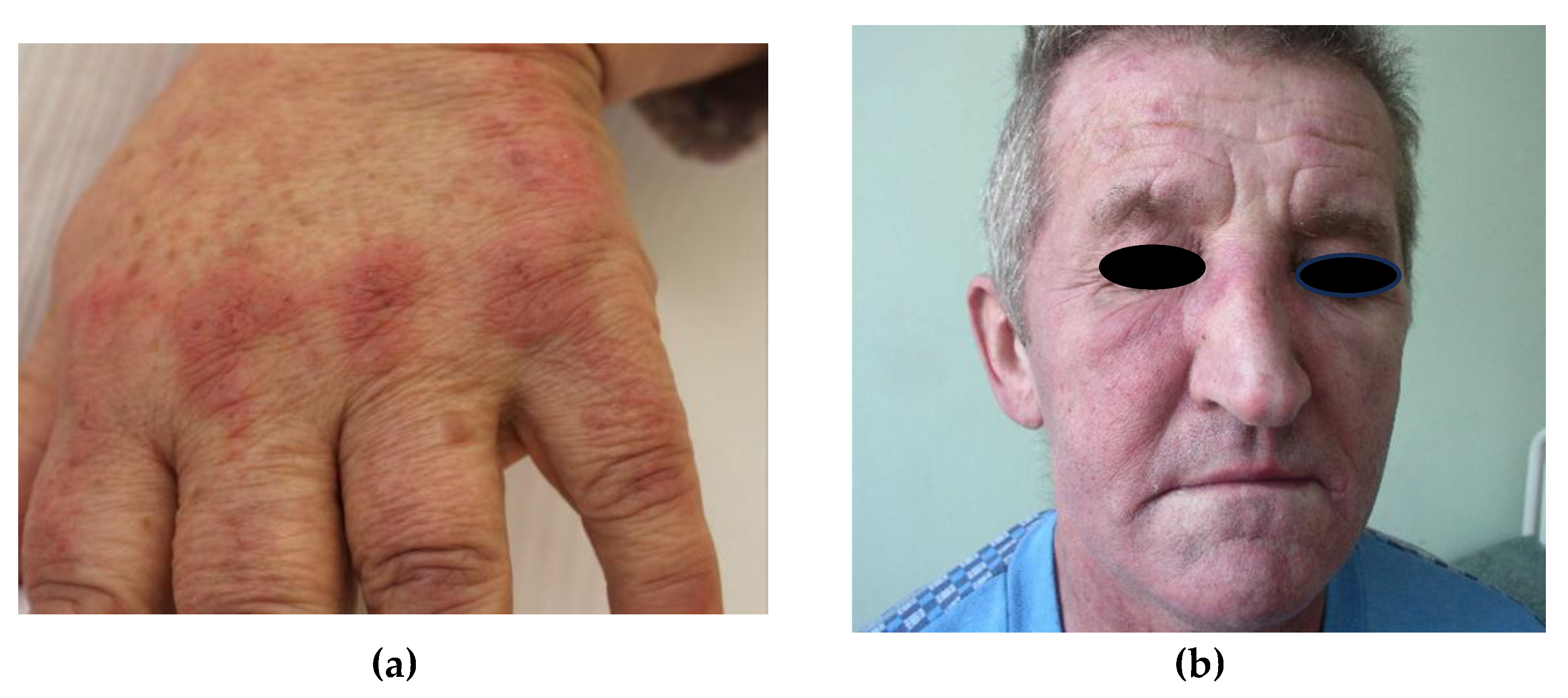 Preprints 148300 g004