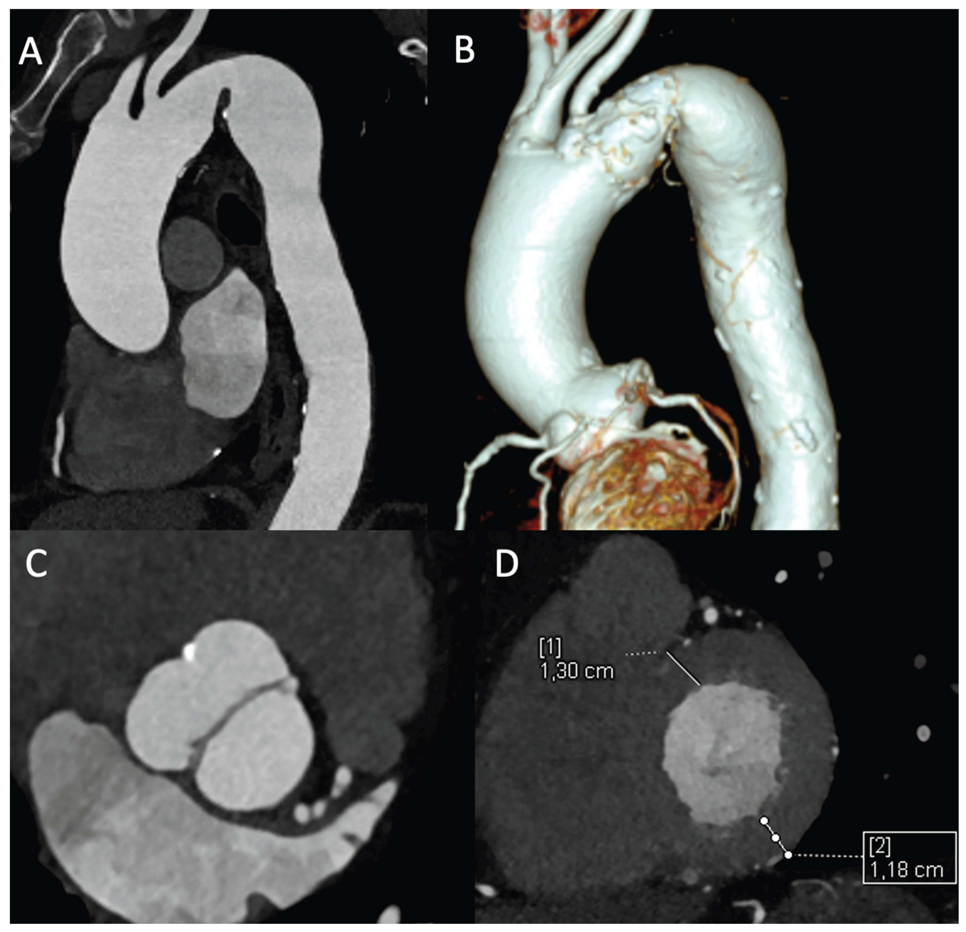 Preprints 191105 g002