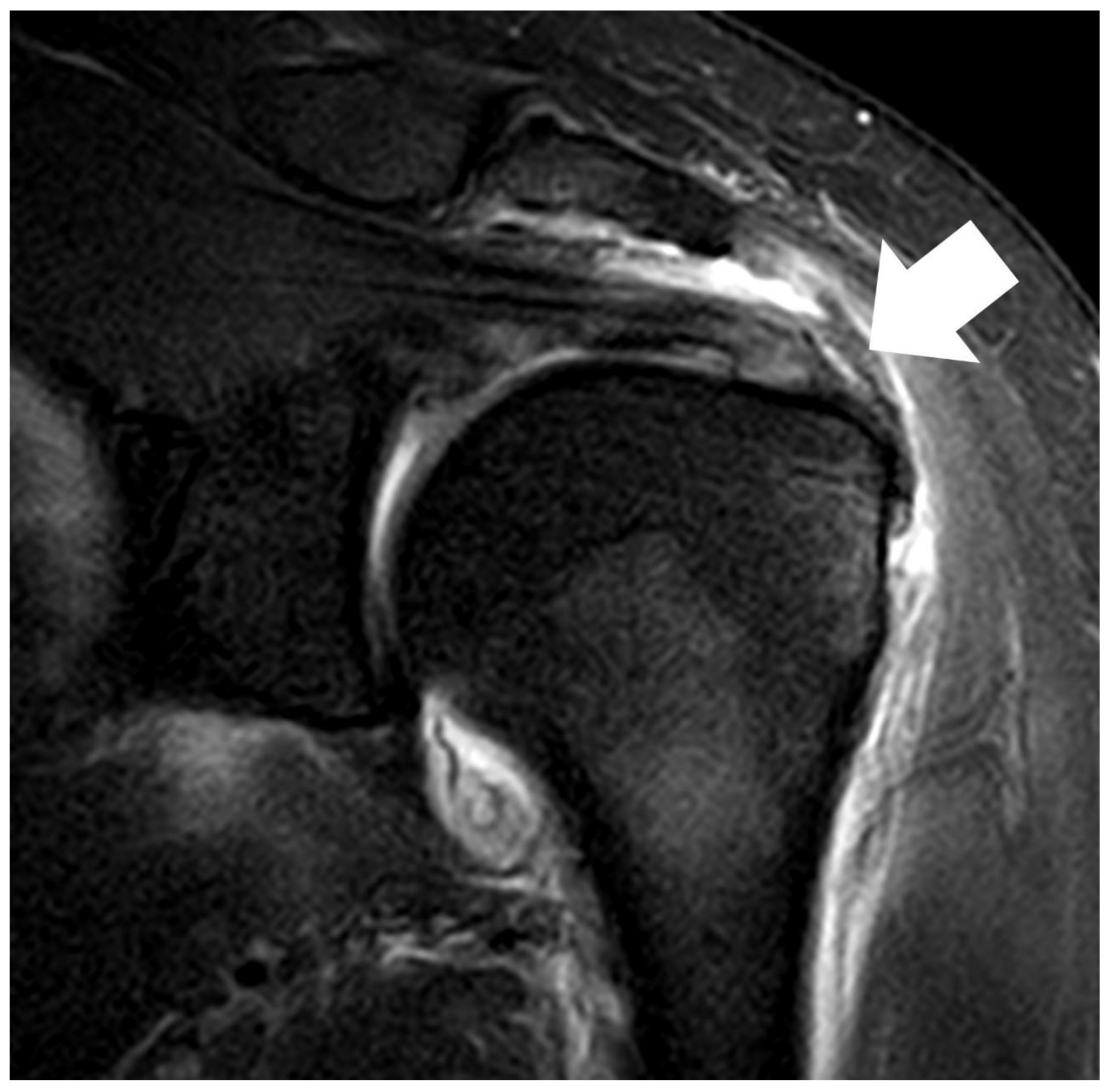 Preprints 155215 g002b
