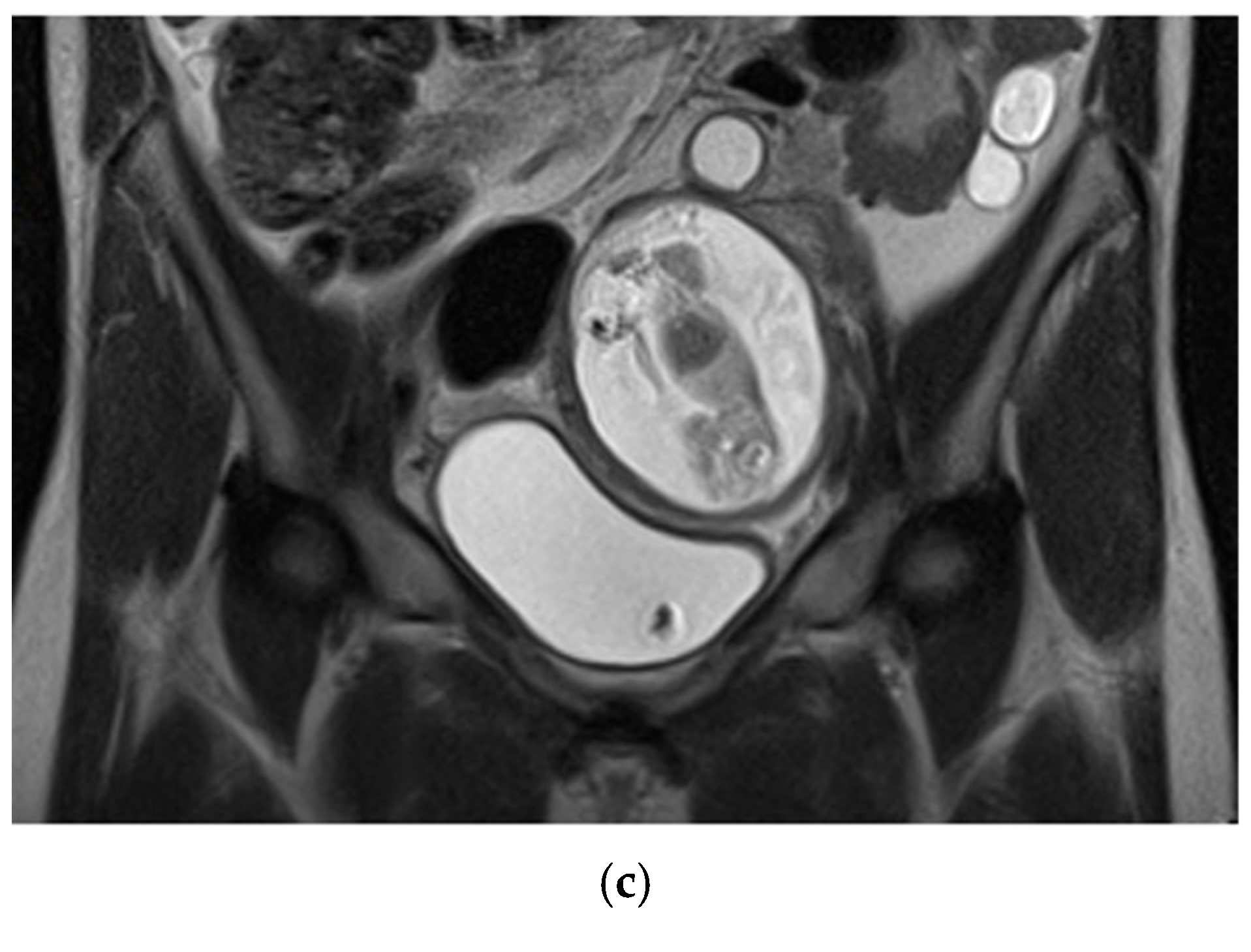 Preprints 177995 g002b