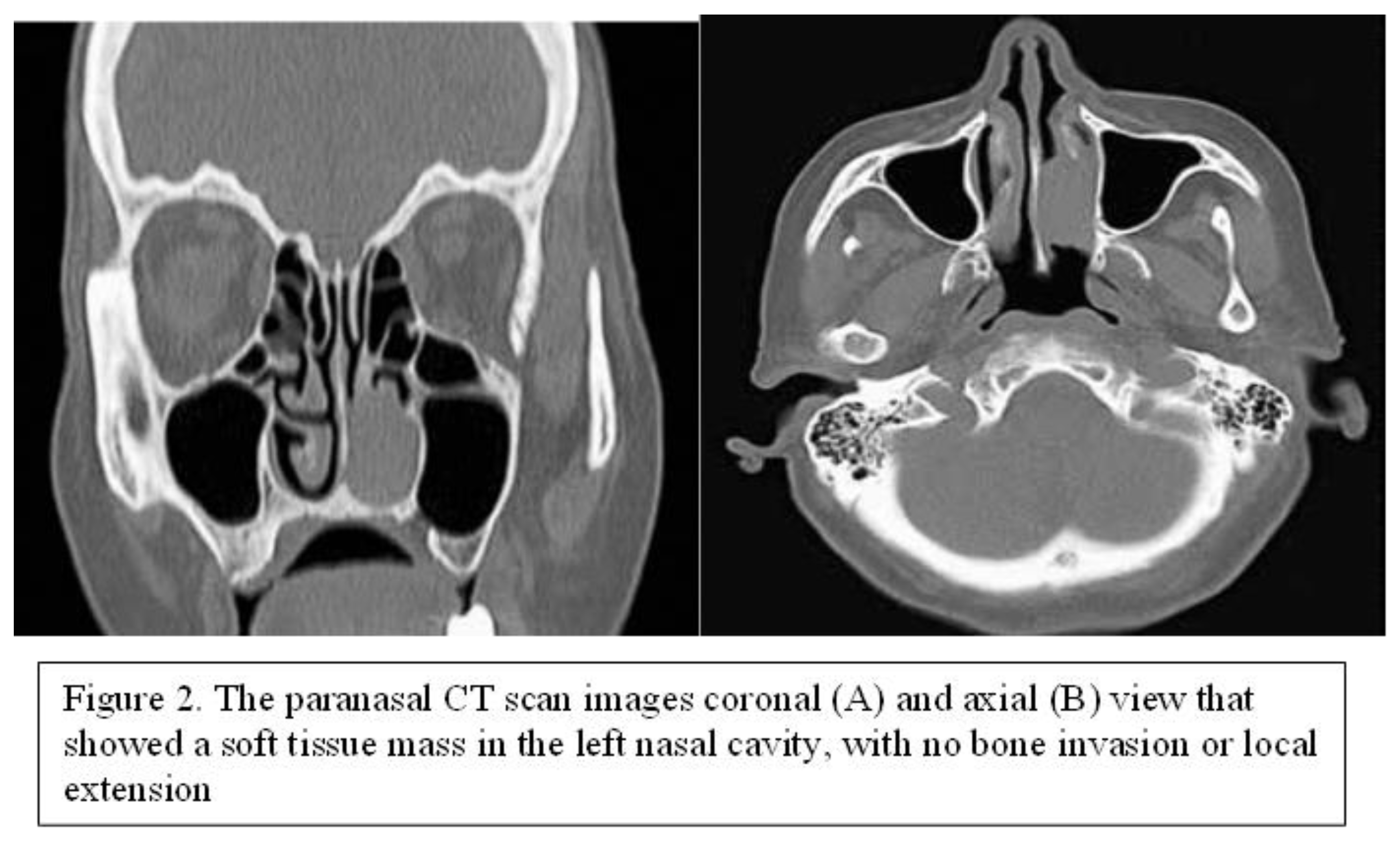 Preprints 166238 i003