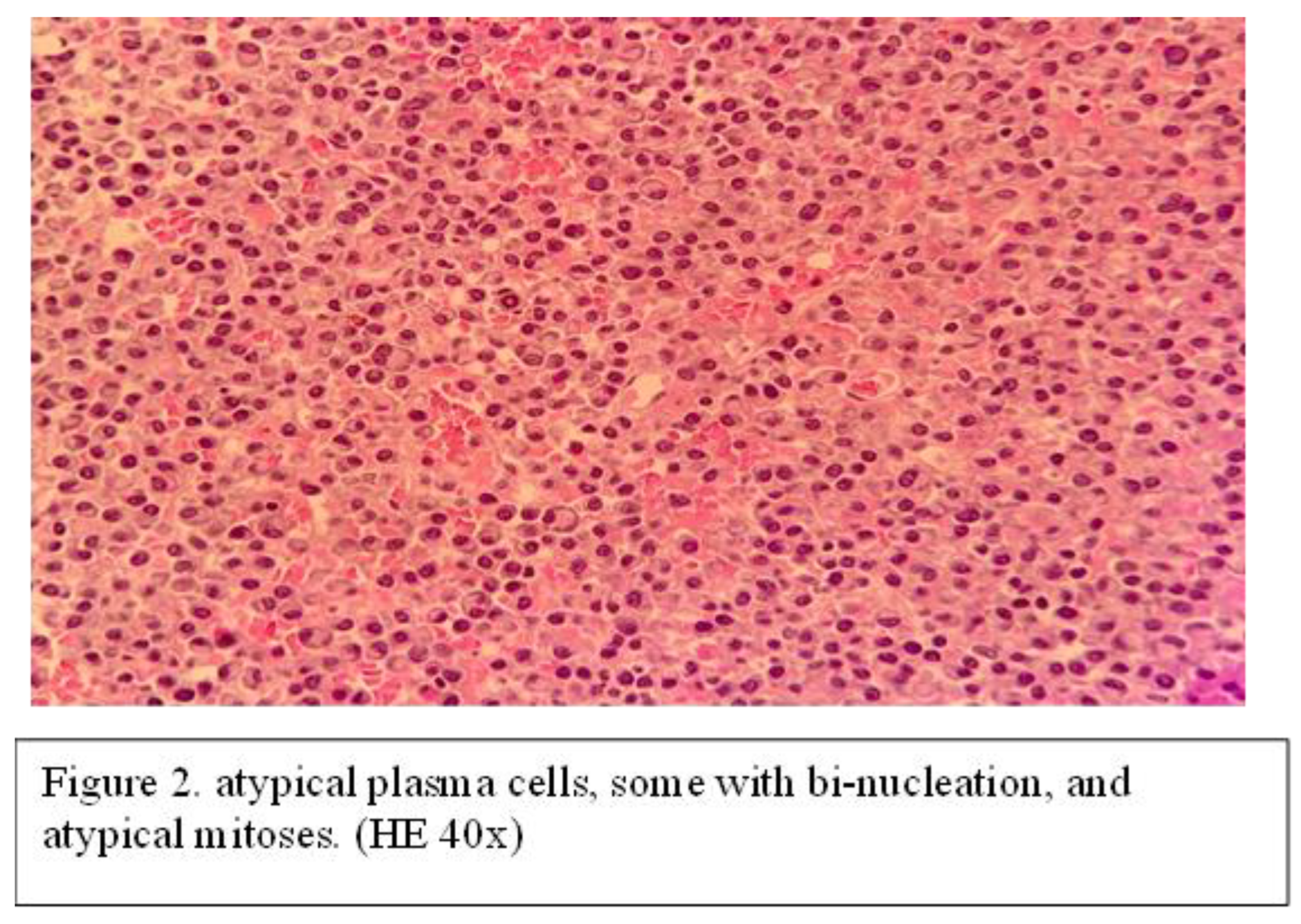 Preprints 166238 i004