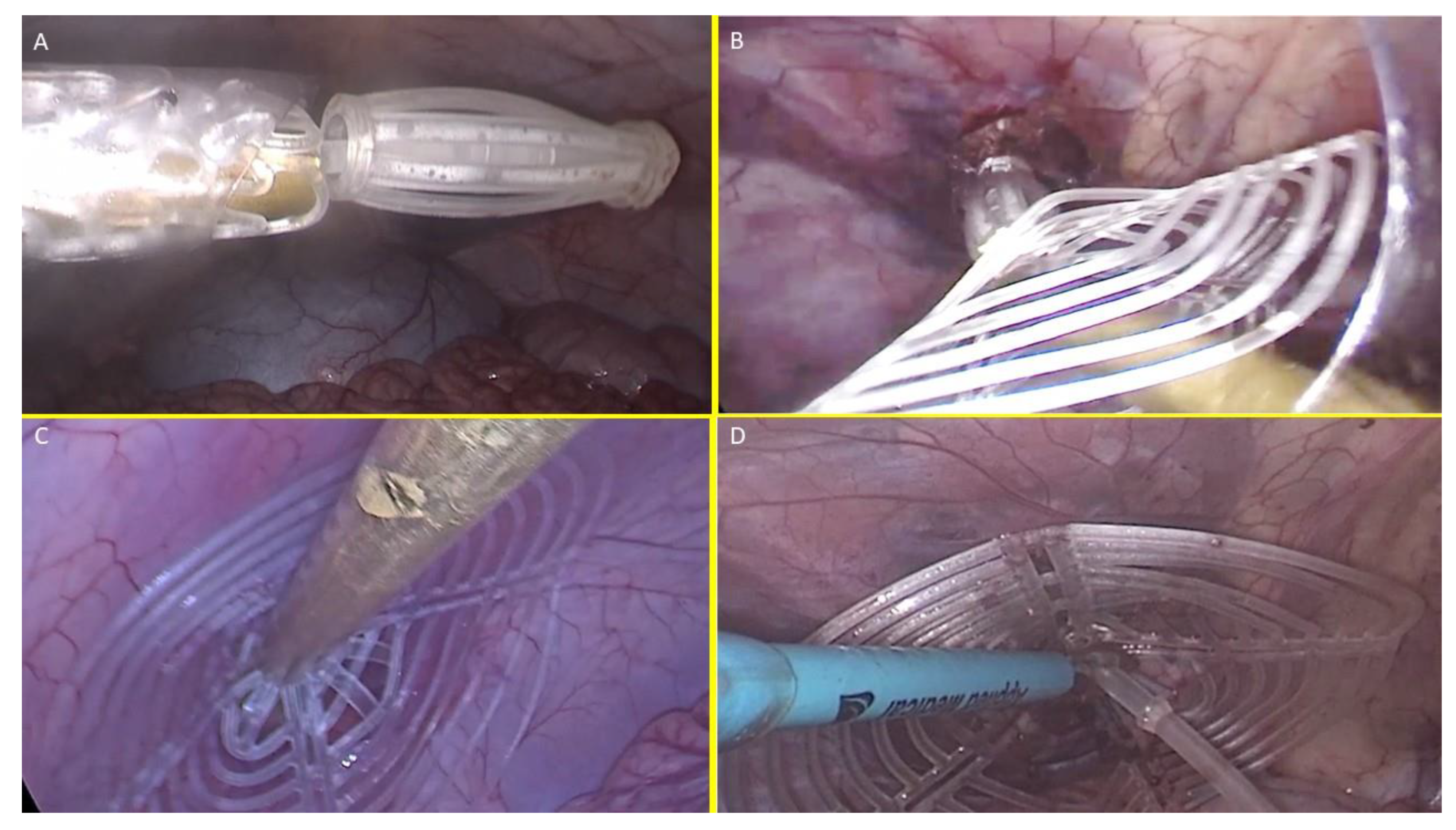 Preprints 149654 g005