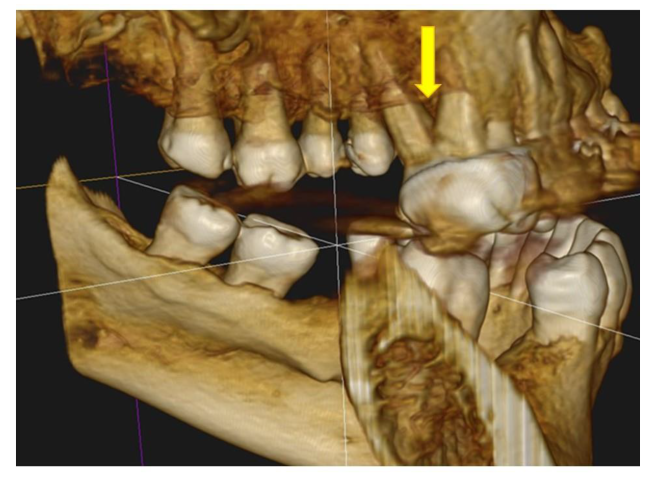 Preprints 165312 g003