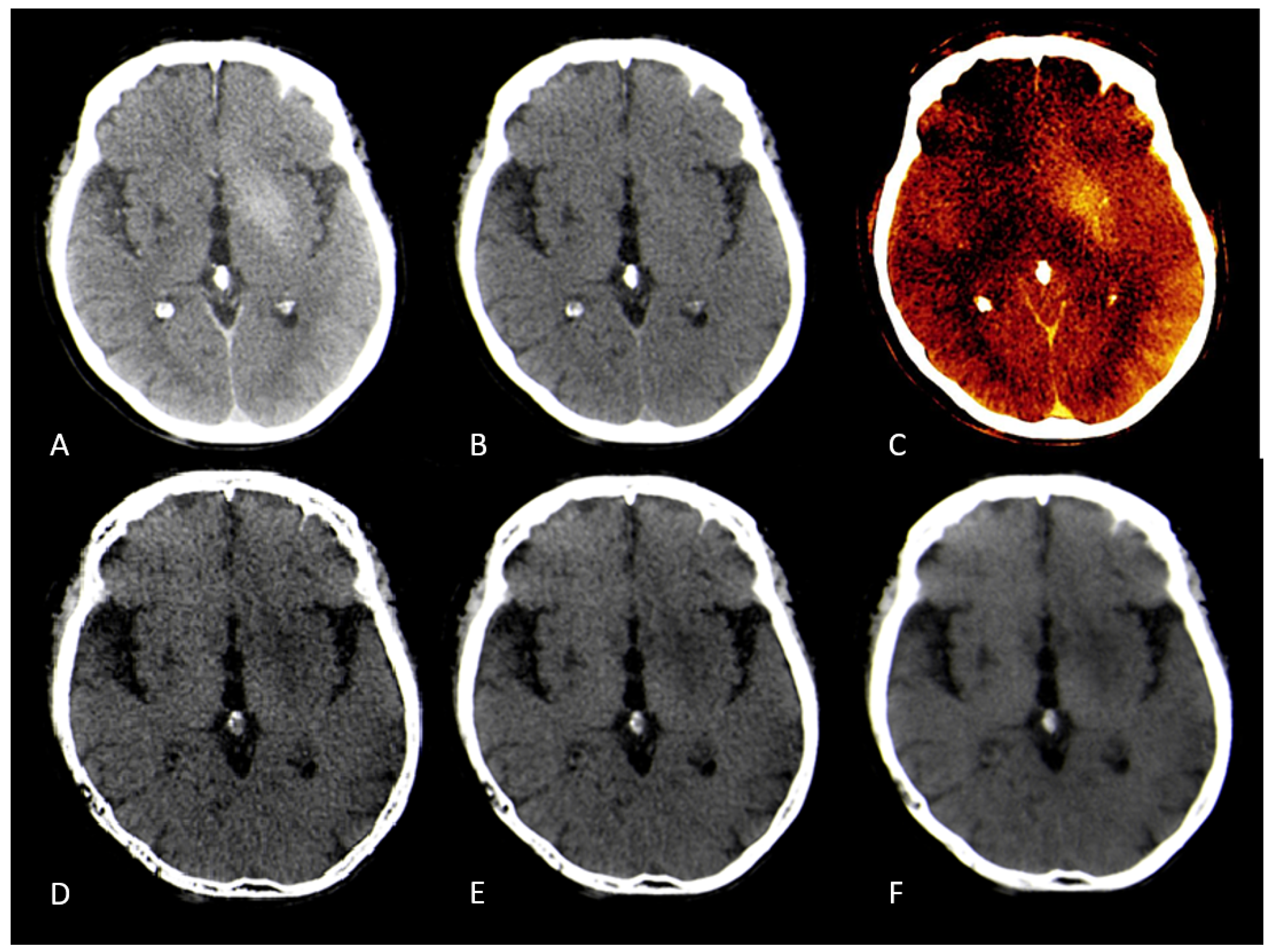 Preprints 169838 g004
