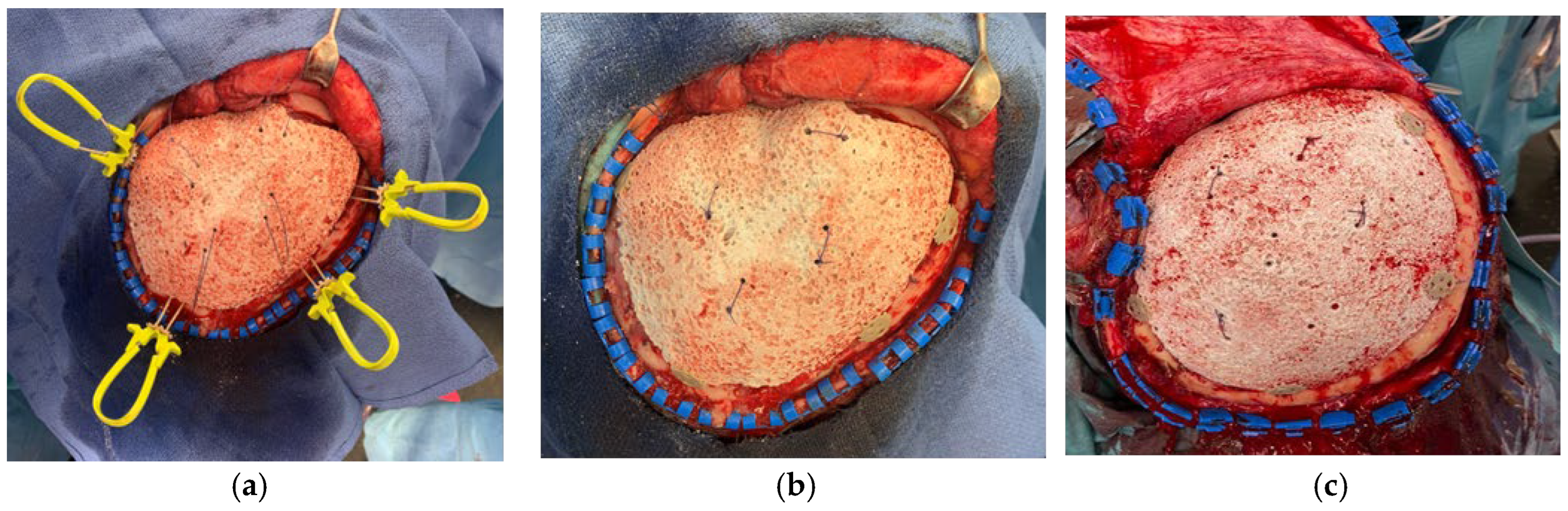 Preprints 178108 g001