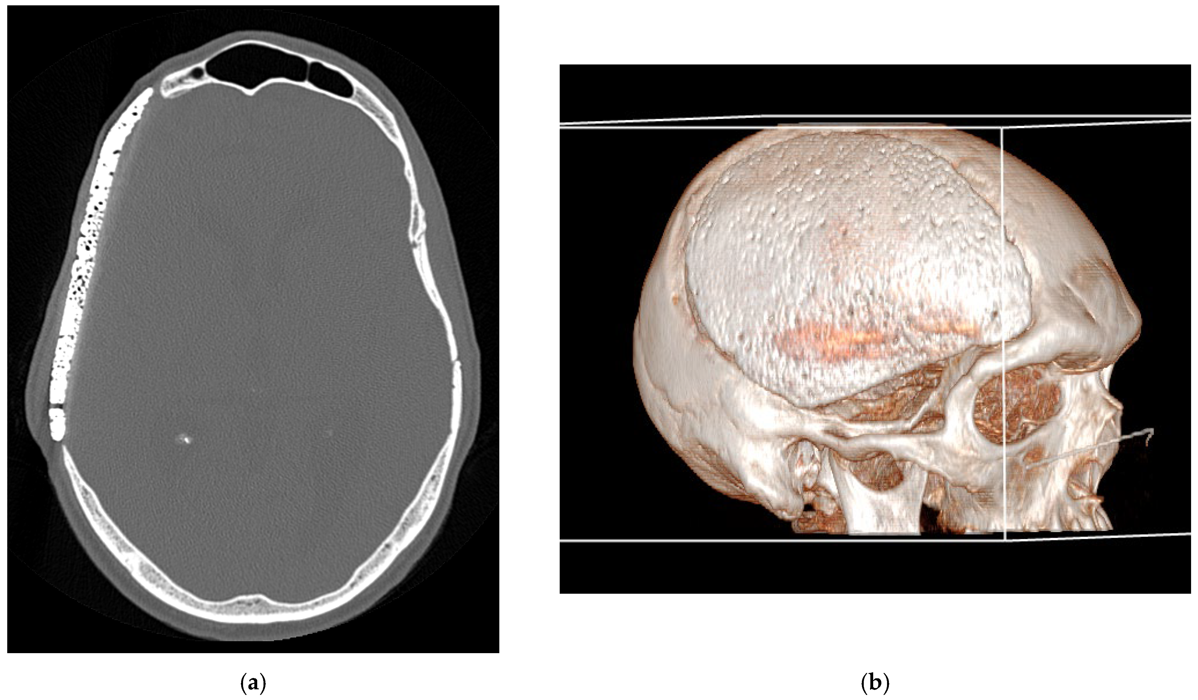 Preprints 178108 g002