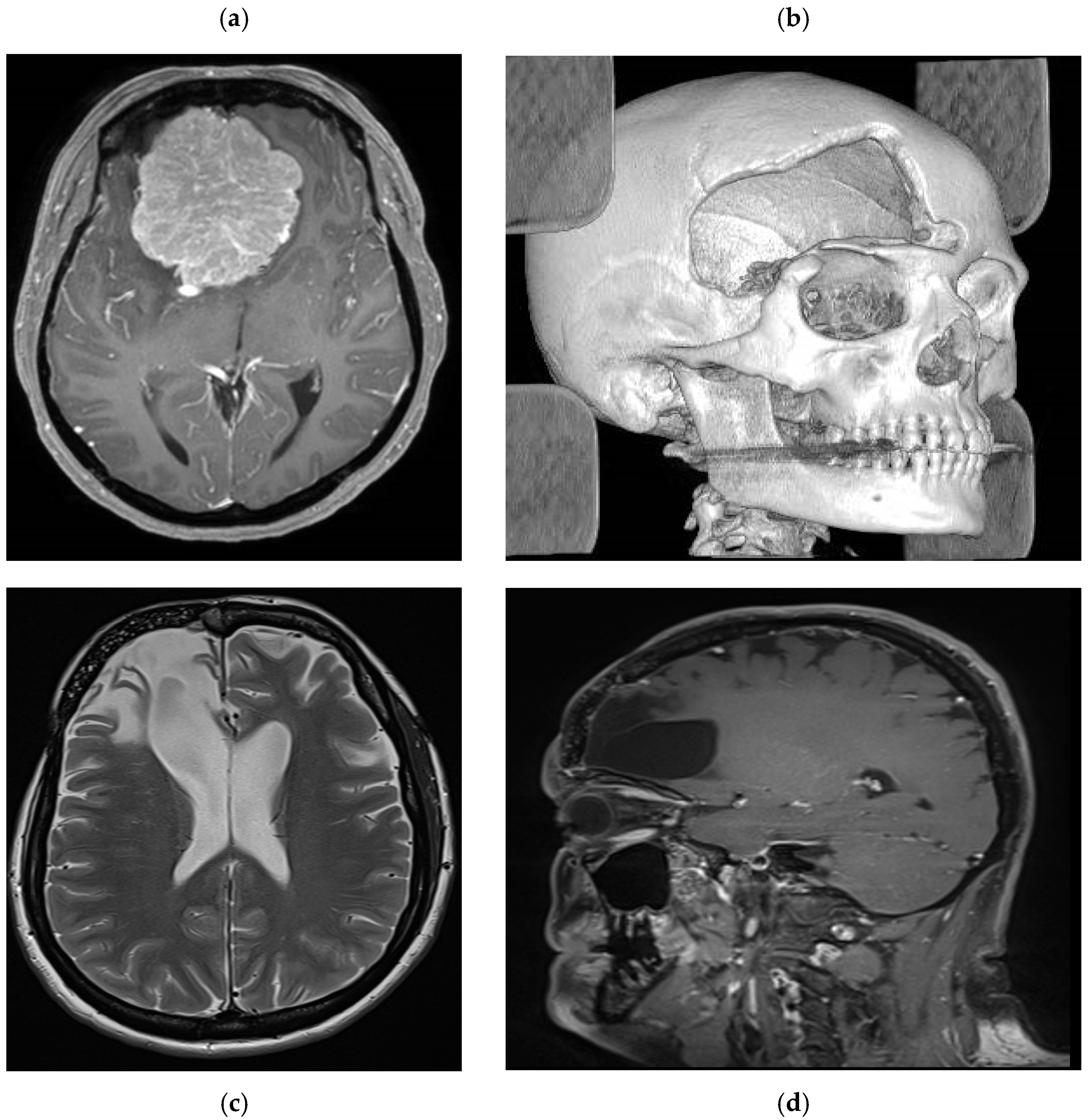 Preprints 178108 g003