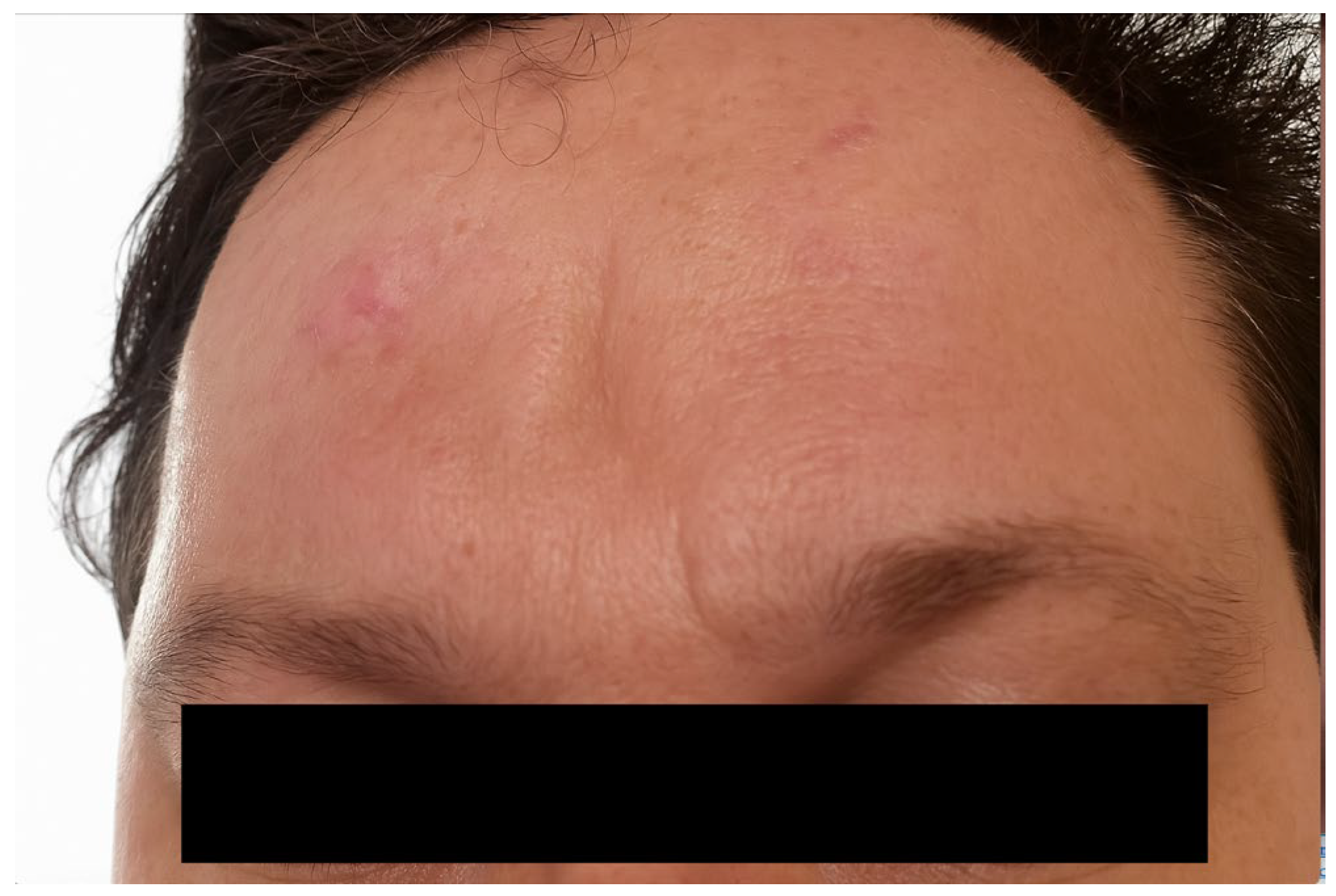 Preprints 178108 g004