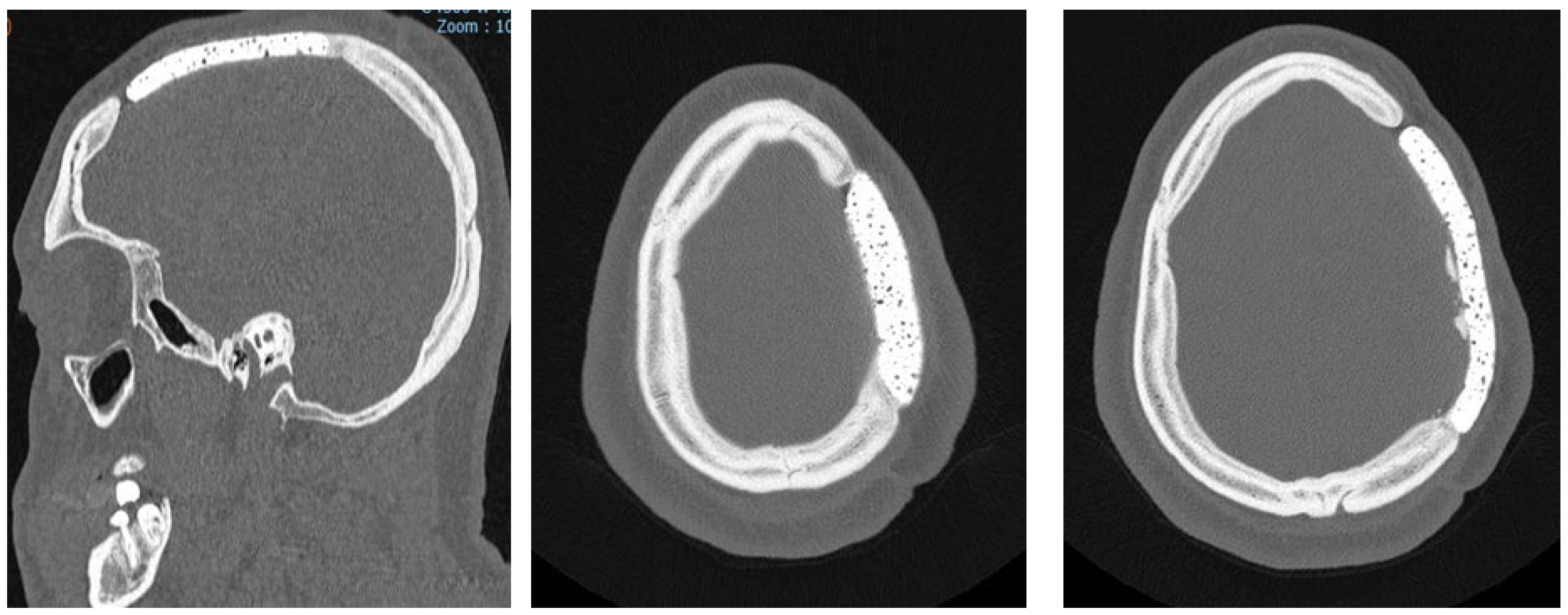 Preprints 178108 g005