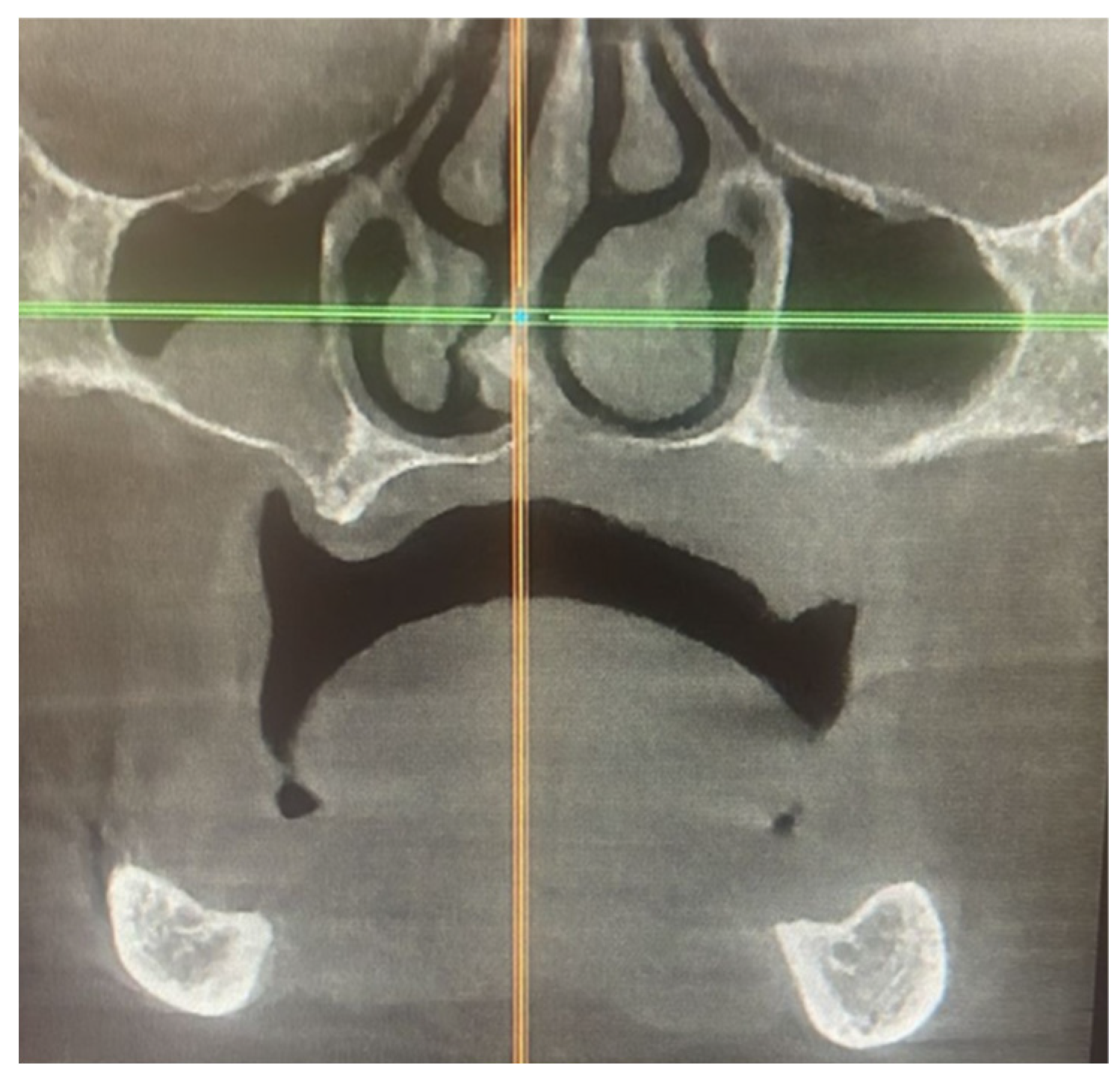 Preprints 83194 g002