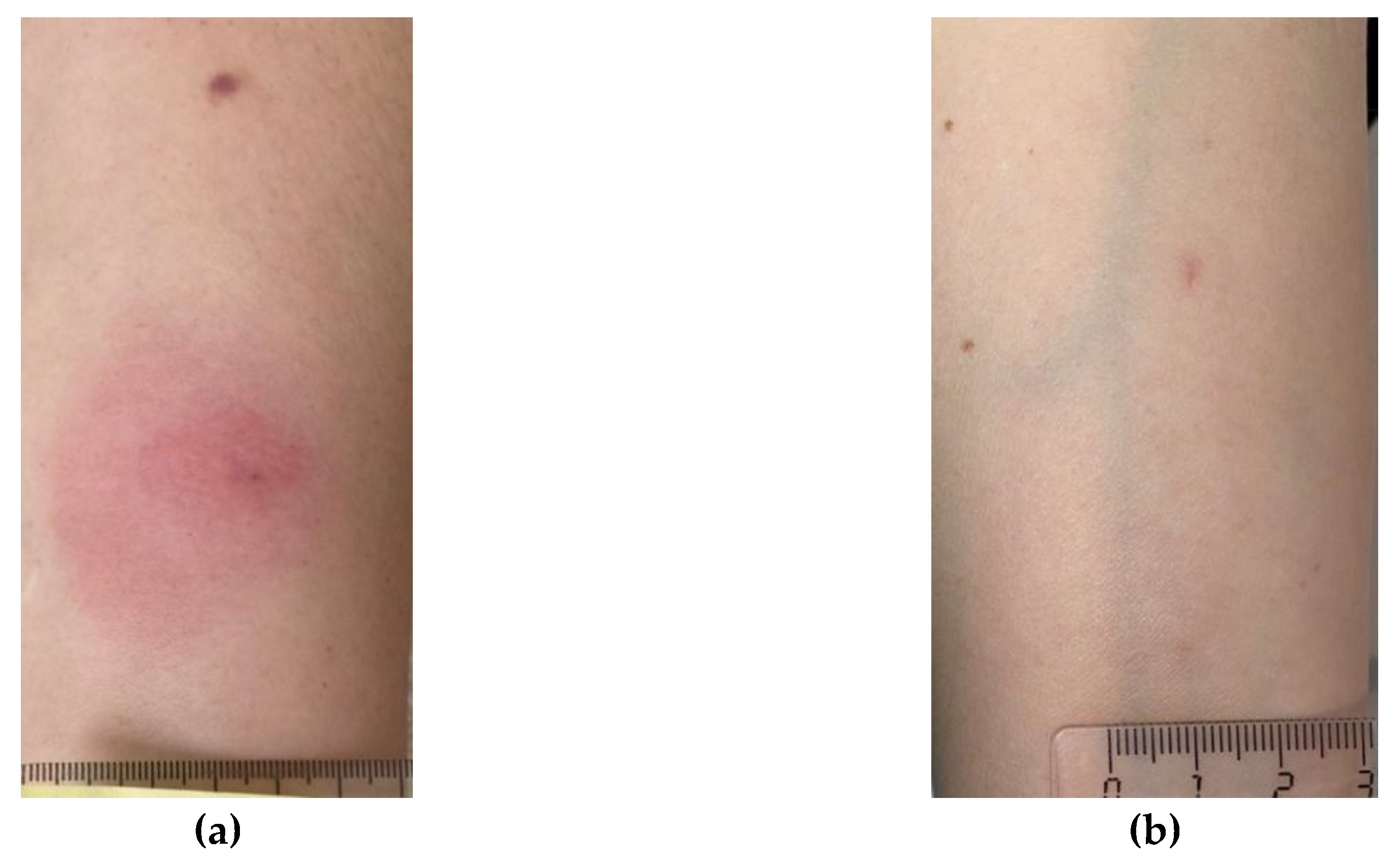 Preprints 171408 g004a