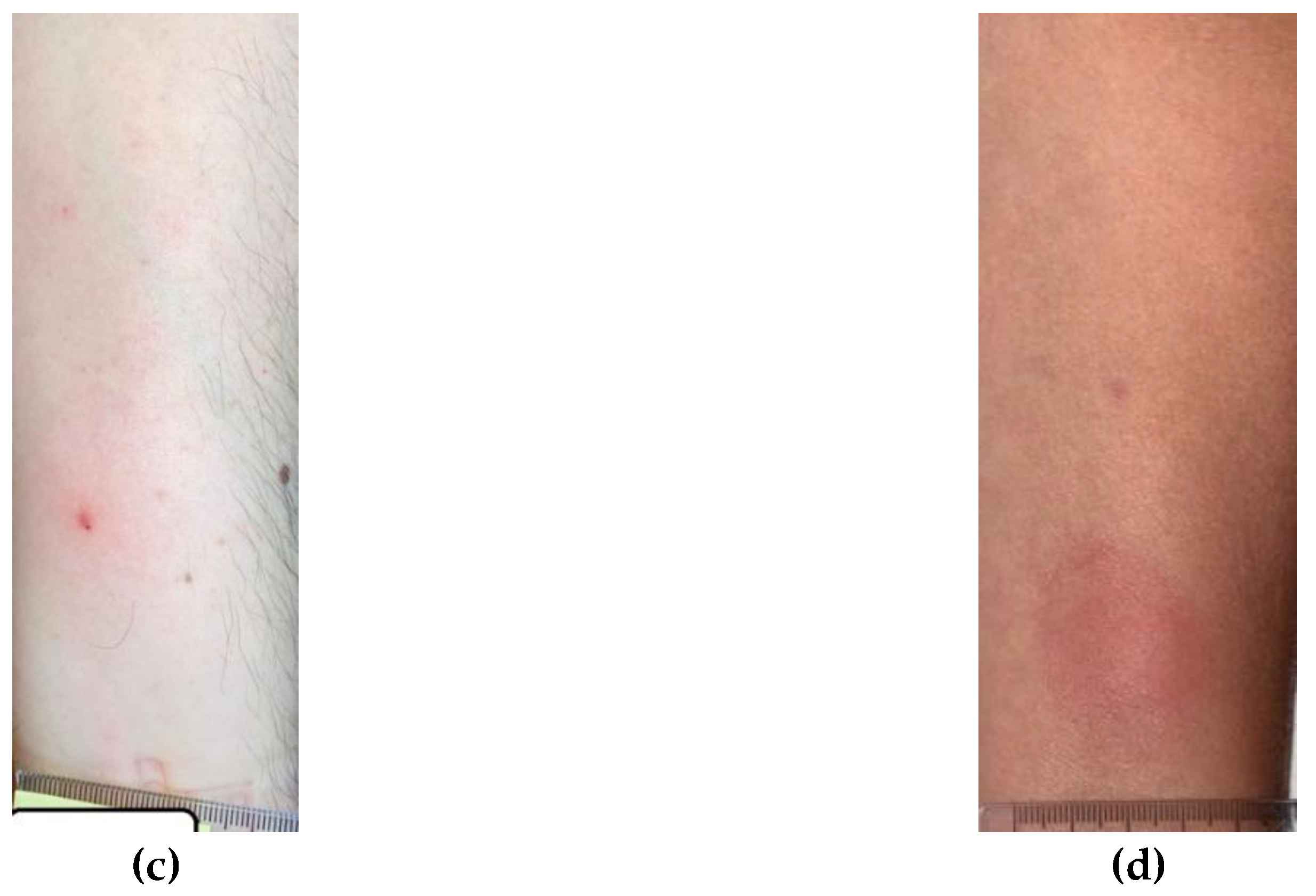 Preprints 171408 g004b