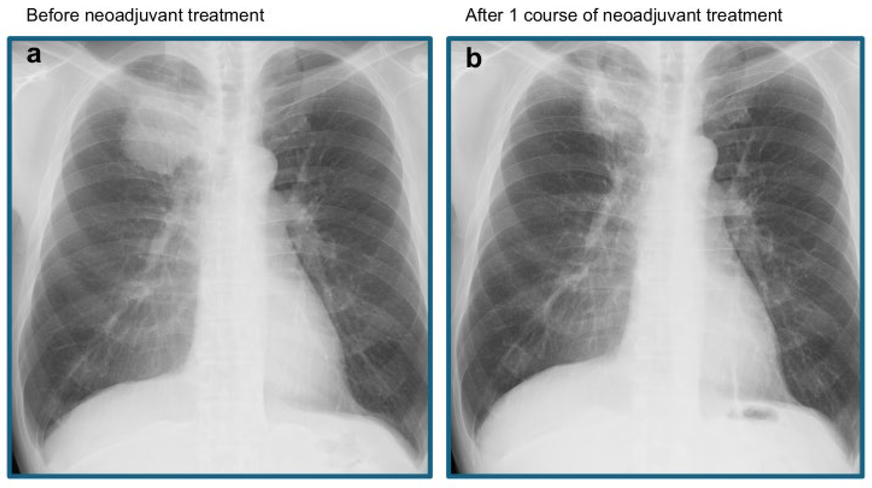 Preprints 170444 g002