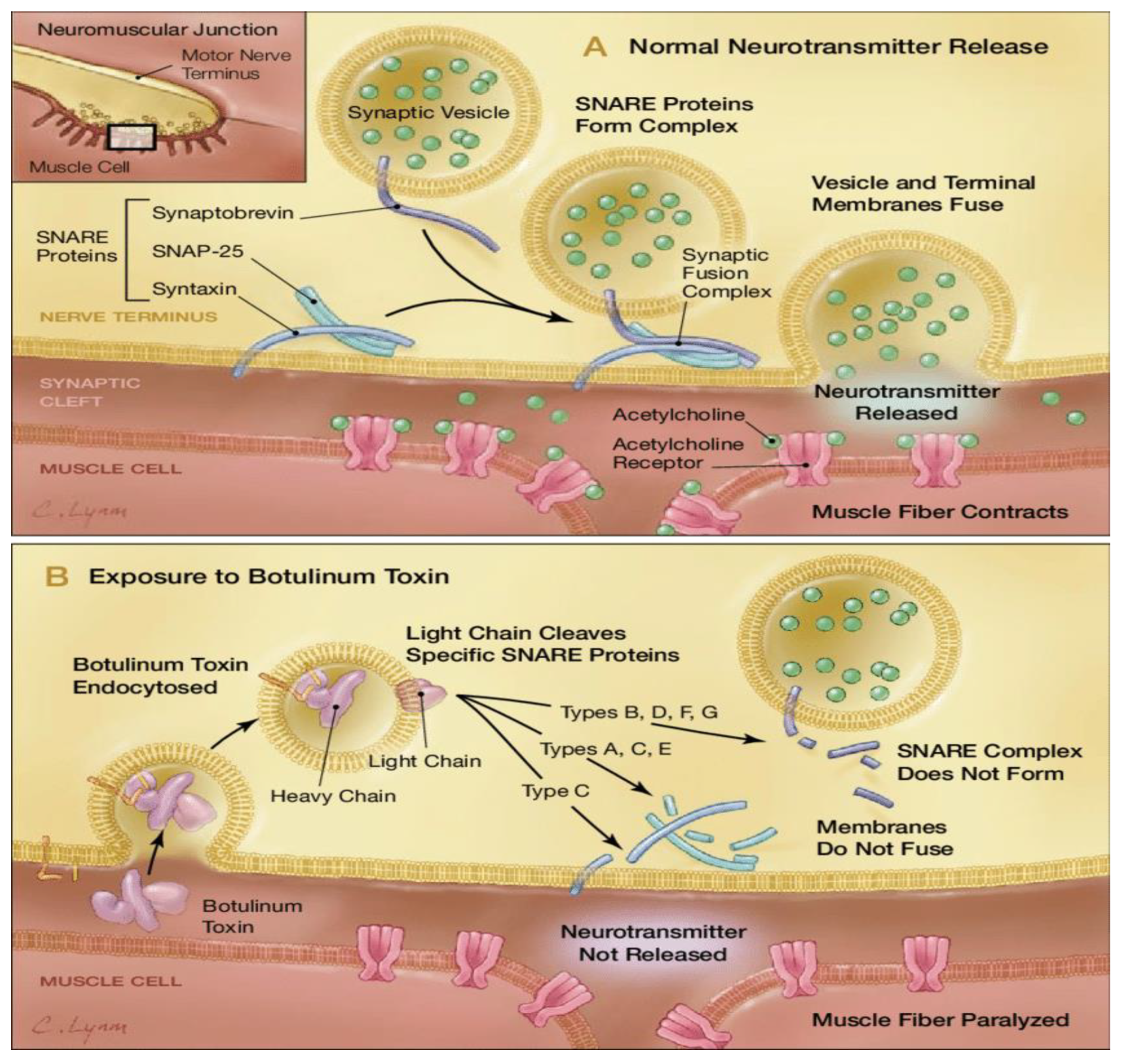 Therapeutic Applications of Botulinum Neurotoxin: Insights