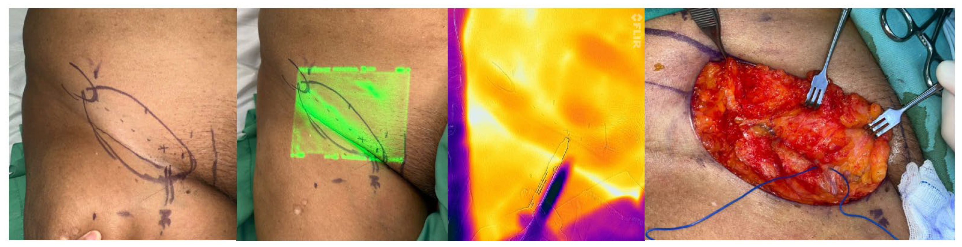 Preprints 149732 g002