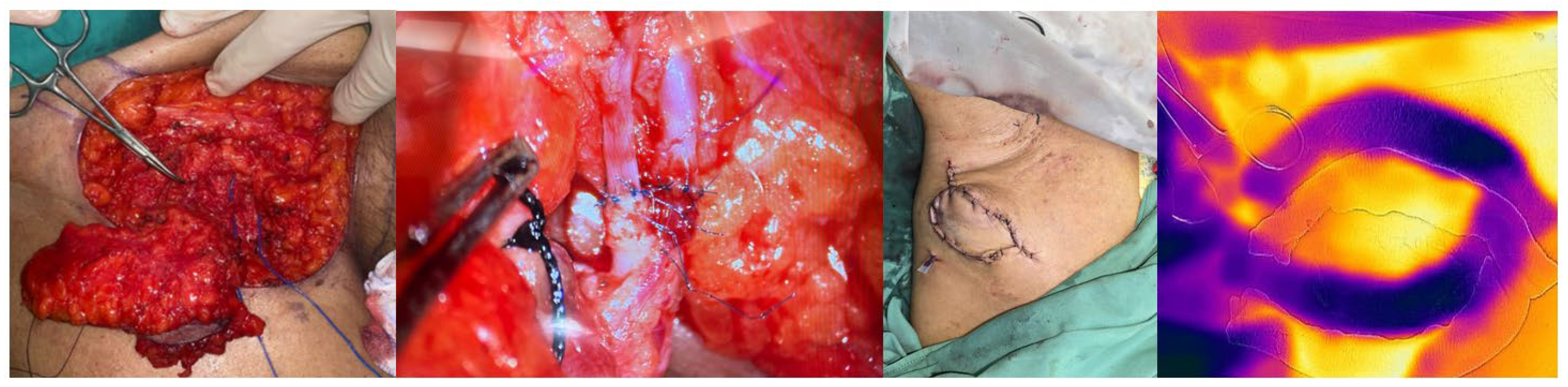 Preprints 149732 g003