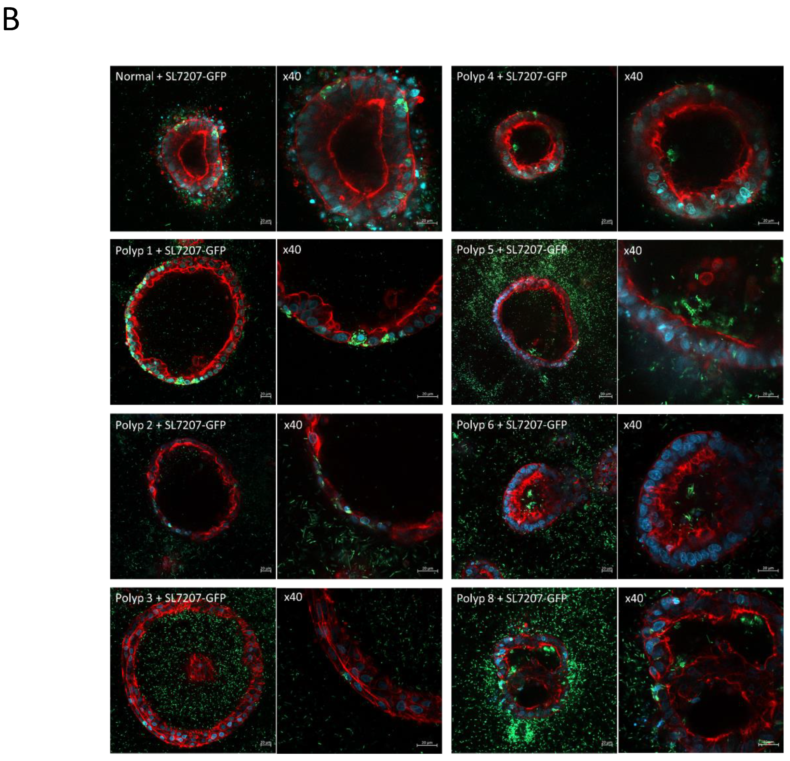 Preprints 153698 g008b