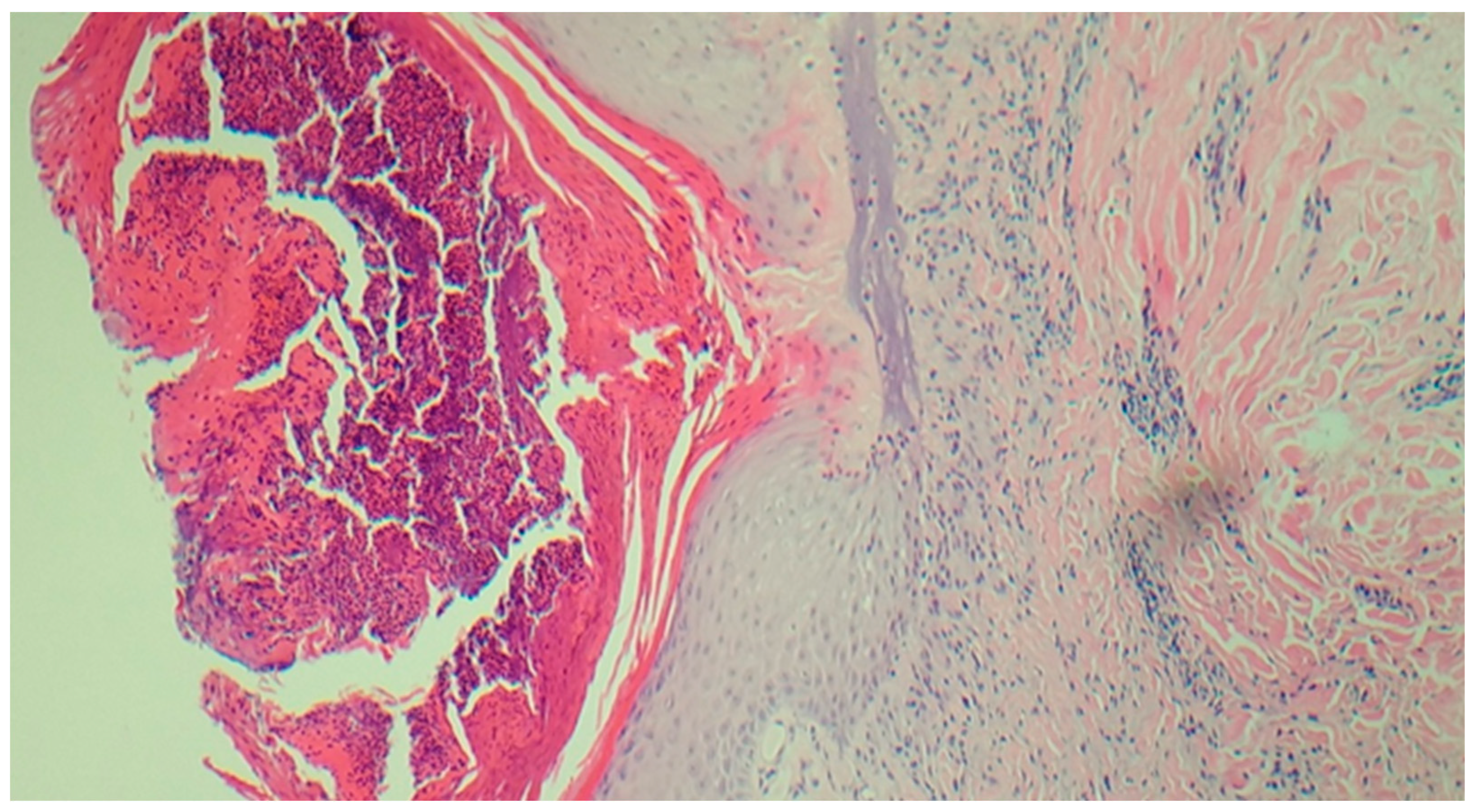 Preprints 74664 g0a2