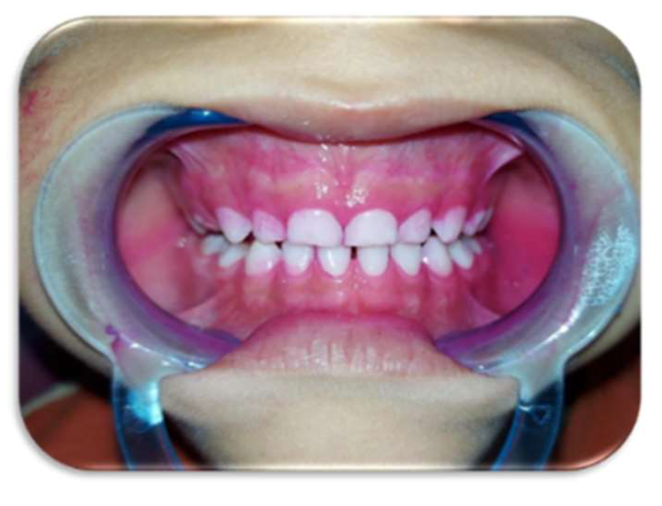 Preprints 146144 g026