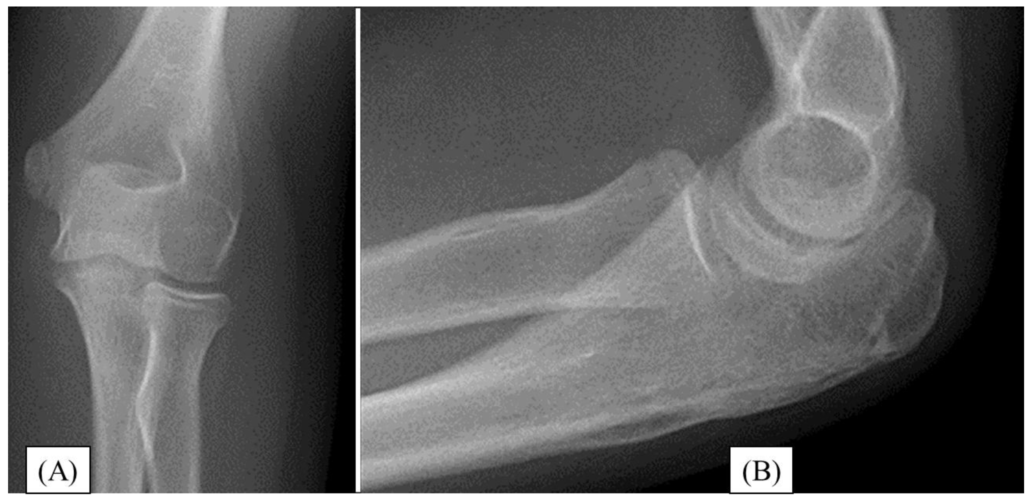 Preprints 149315 g002