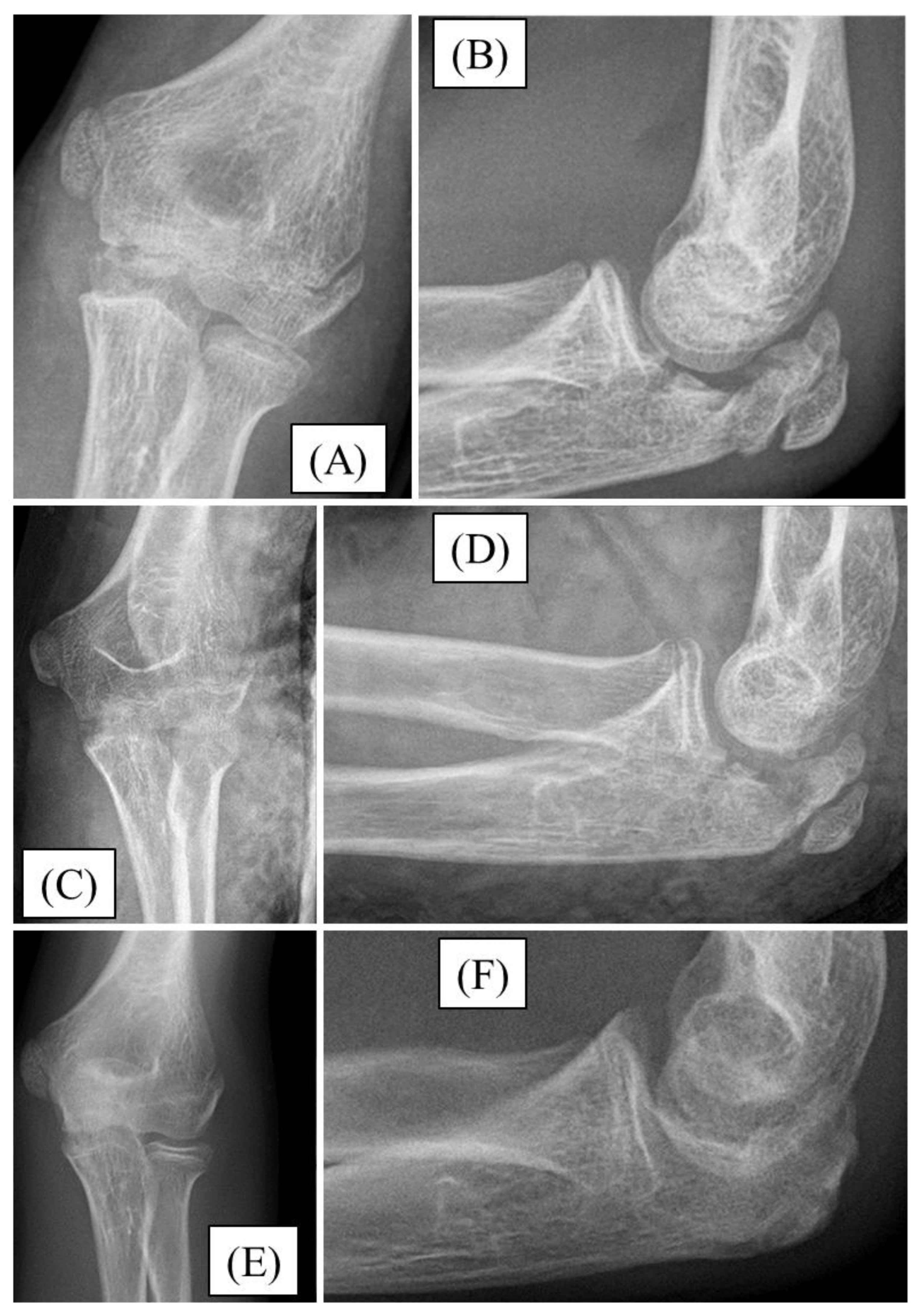 Preprints 149315 g003