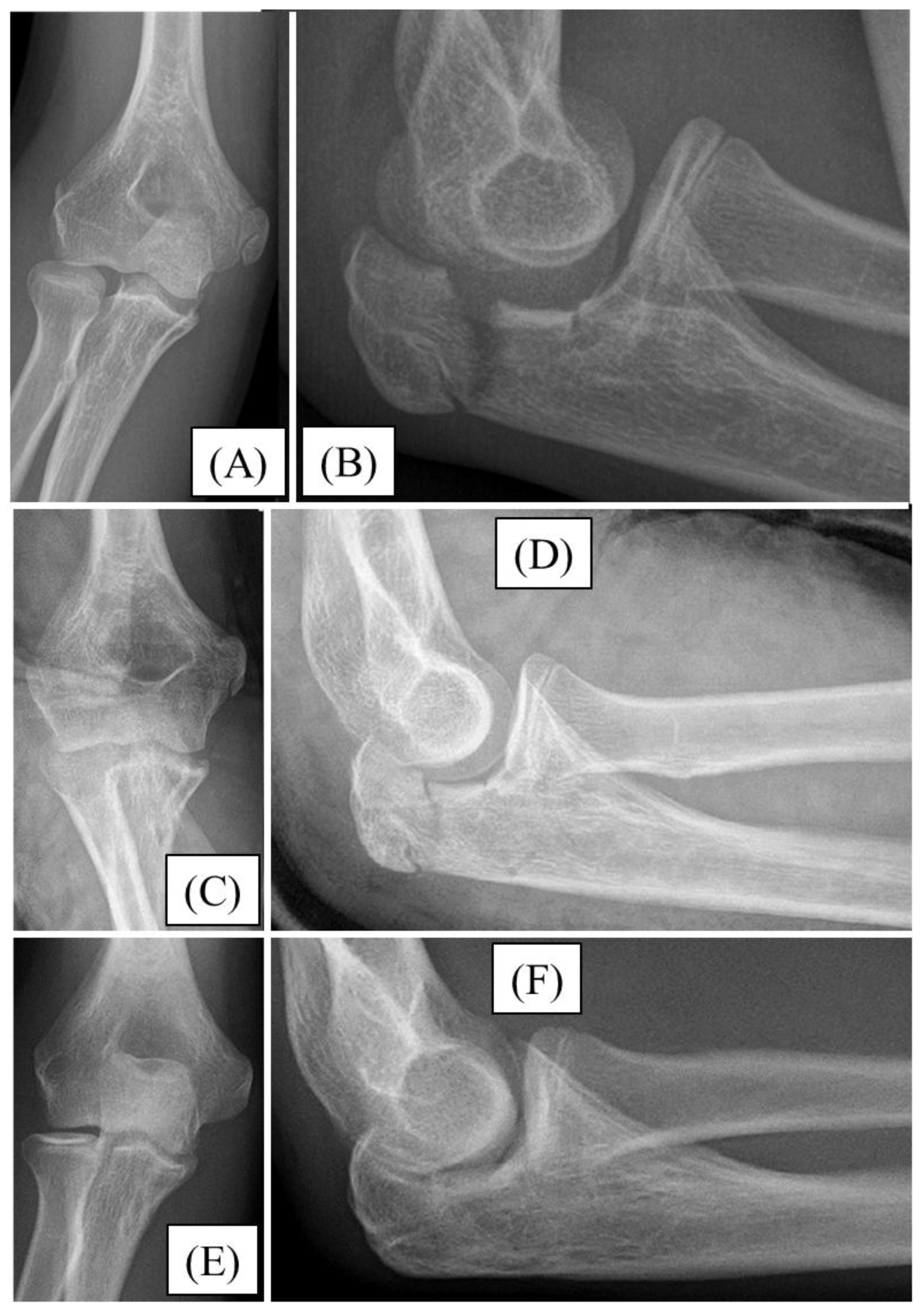 Preprints 149315 g004