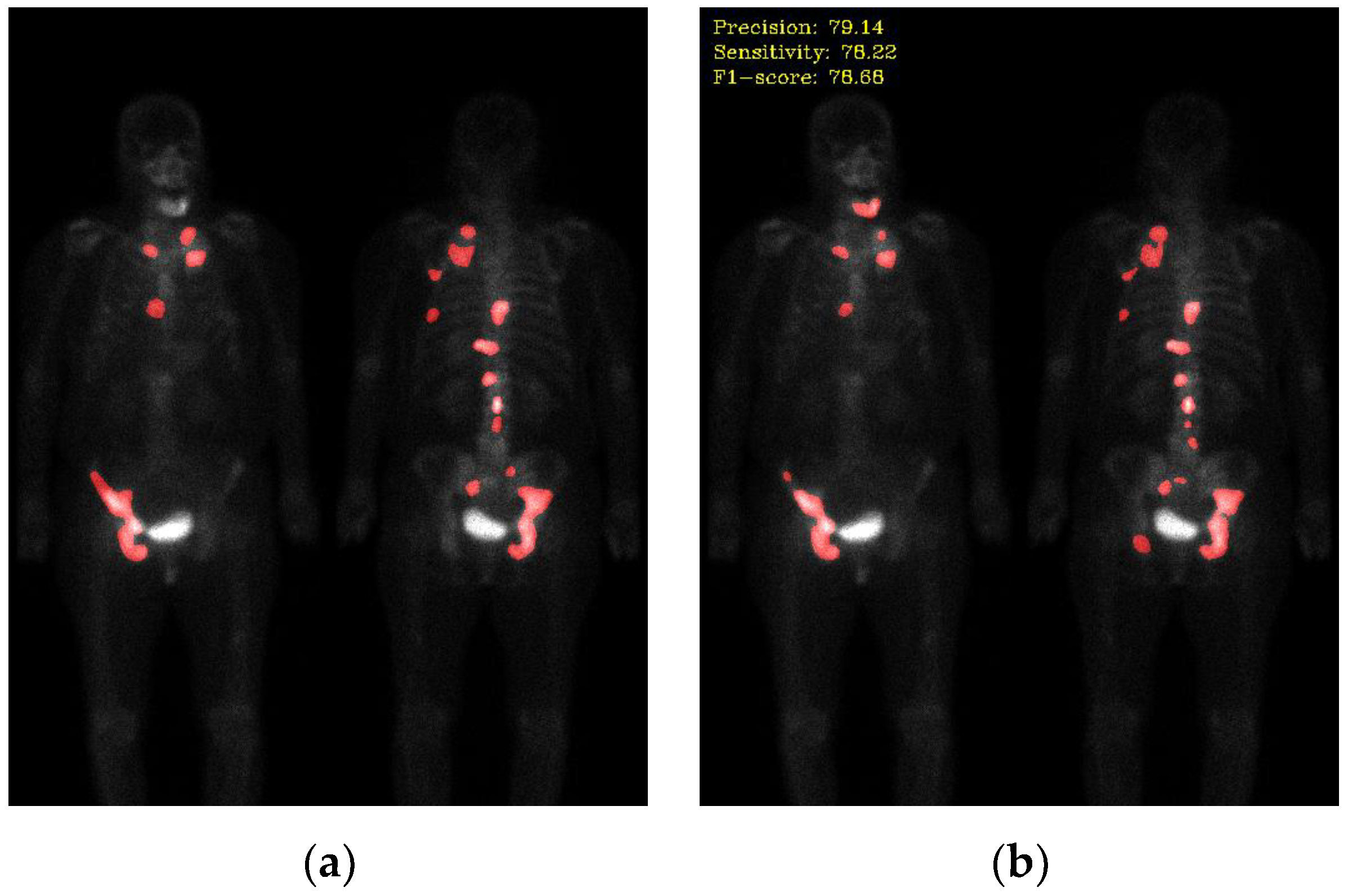 Preprints 78708 g004