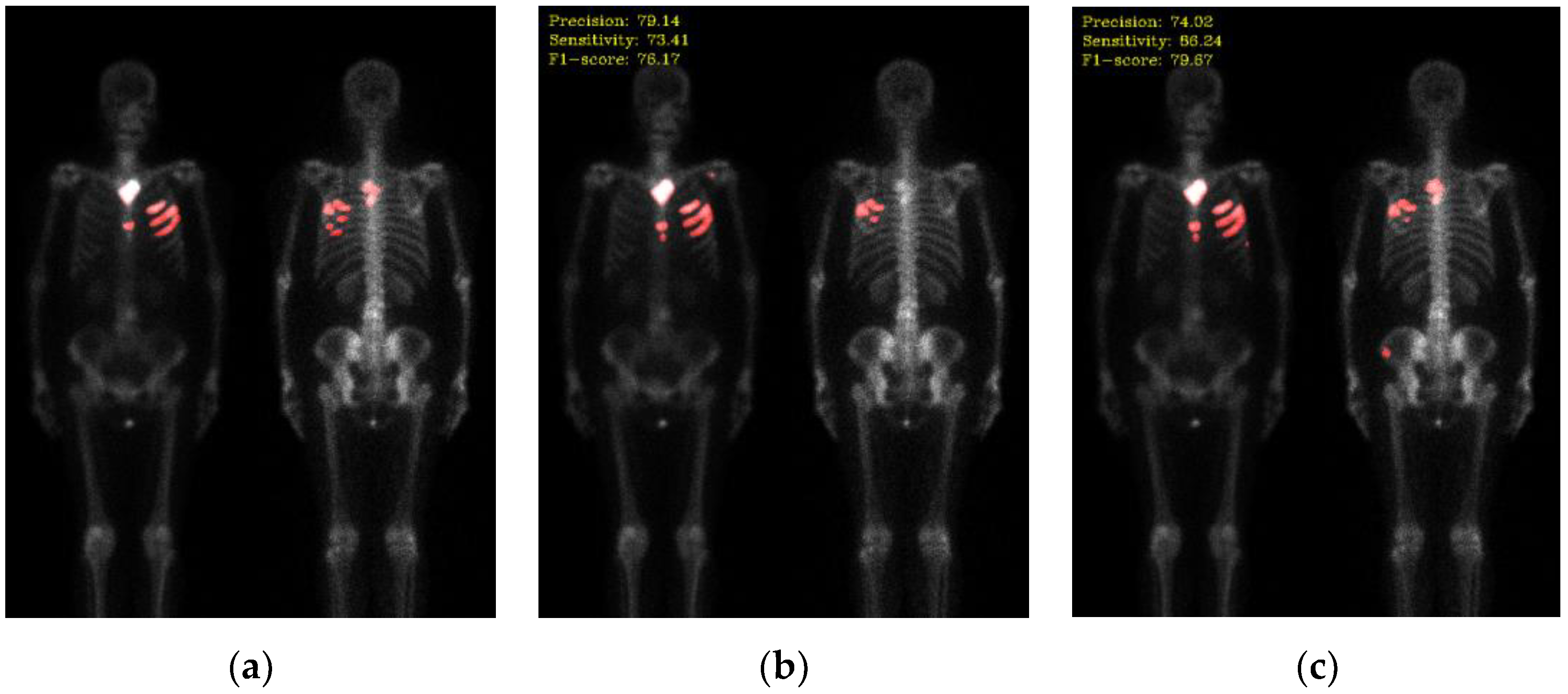 Preprints 78708 g005