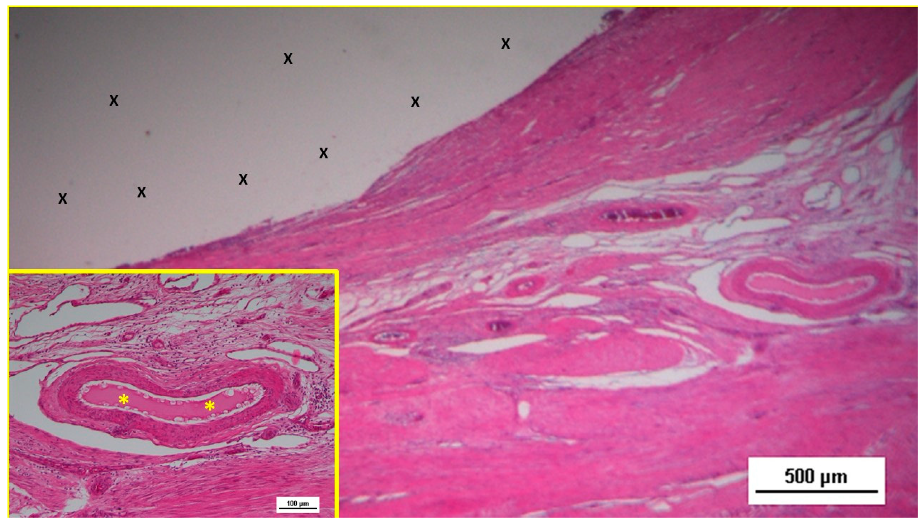 Preprints 141535 g014