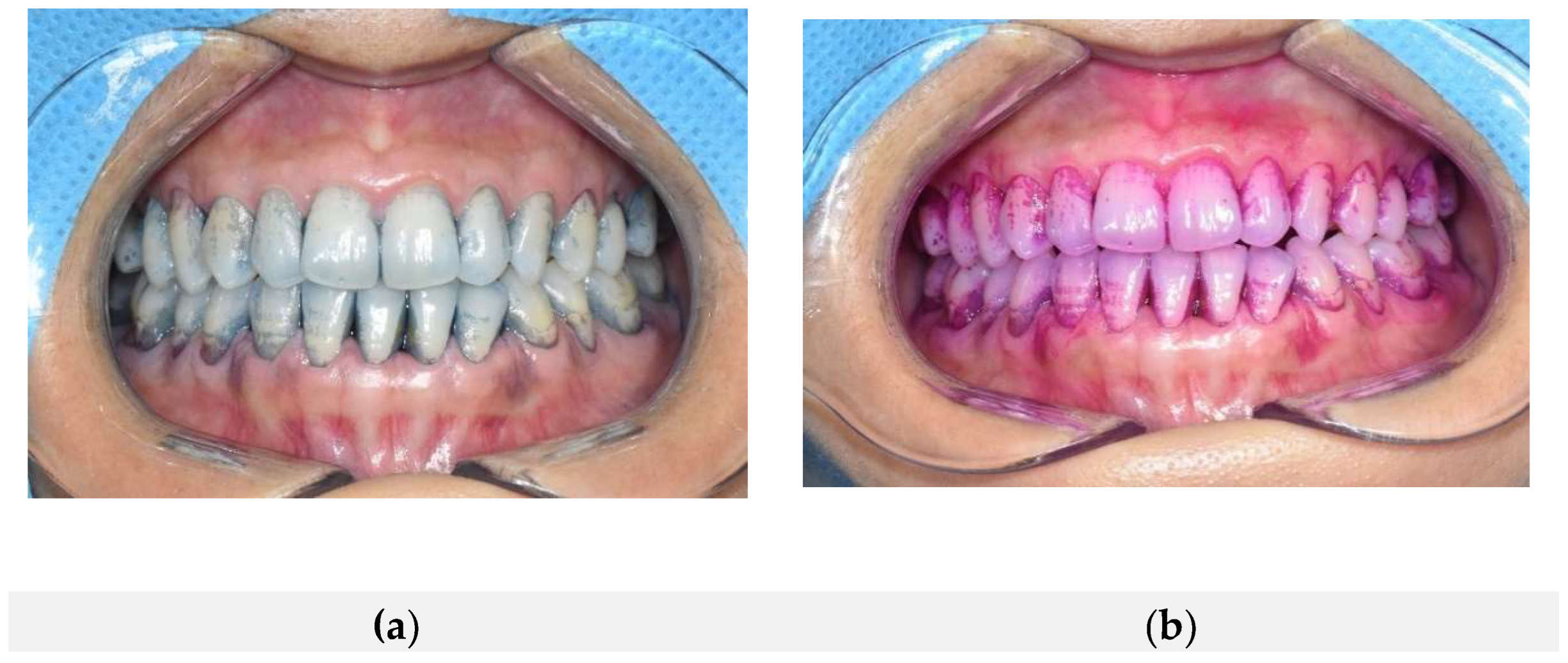 Preprints 157696 g001